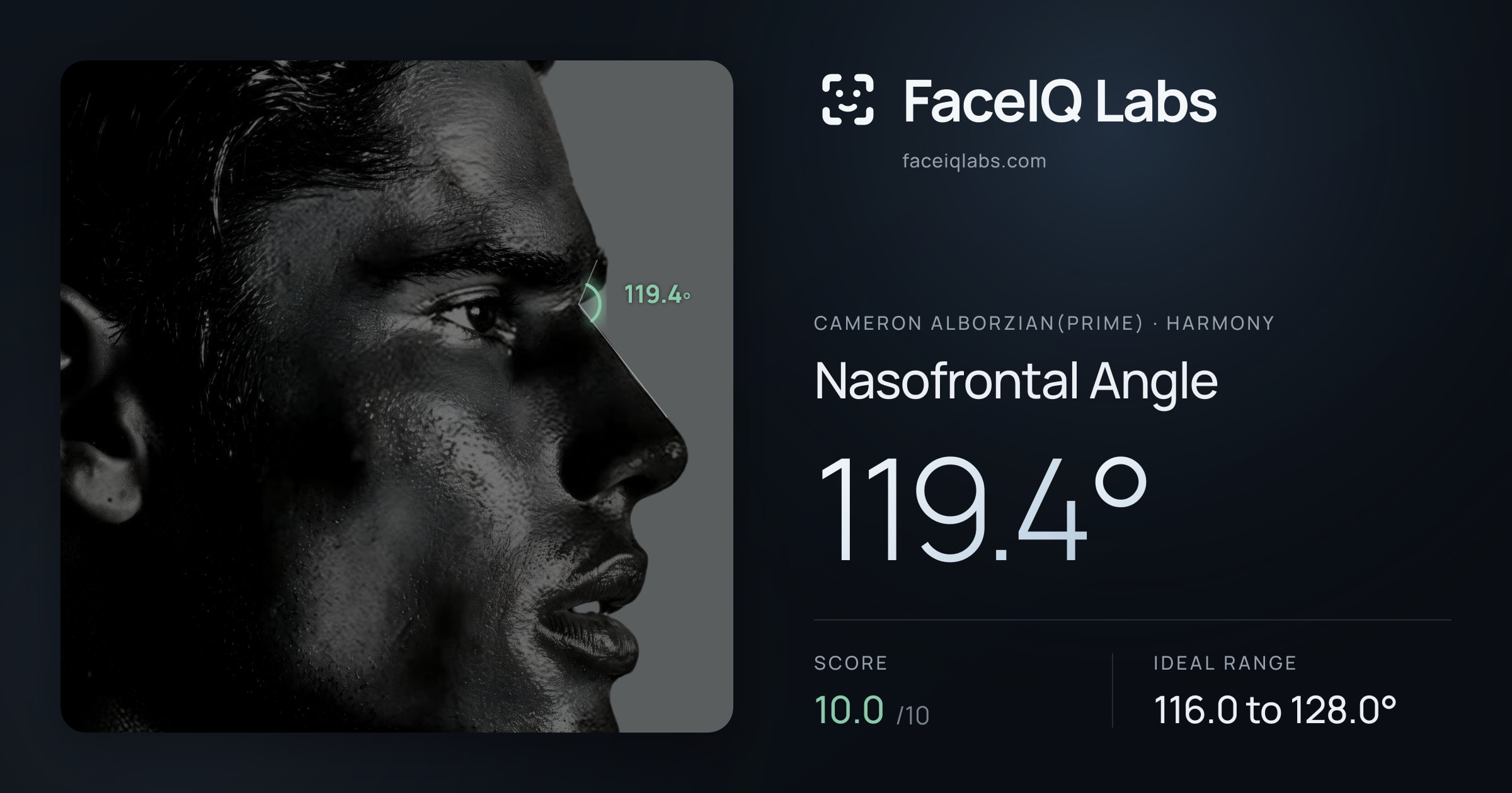 Cameron Alborzian(Prime) Nasofrontal Angle: 119.4°, drawn on the photo