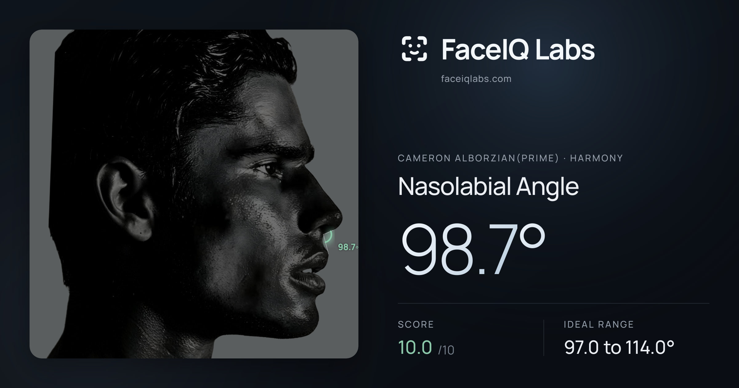 Cameron Alborzian(Prime) Nasolabial Angle: 98.7°, drawn on the photo