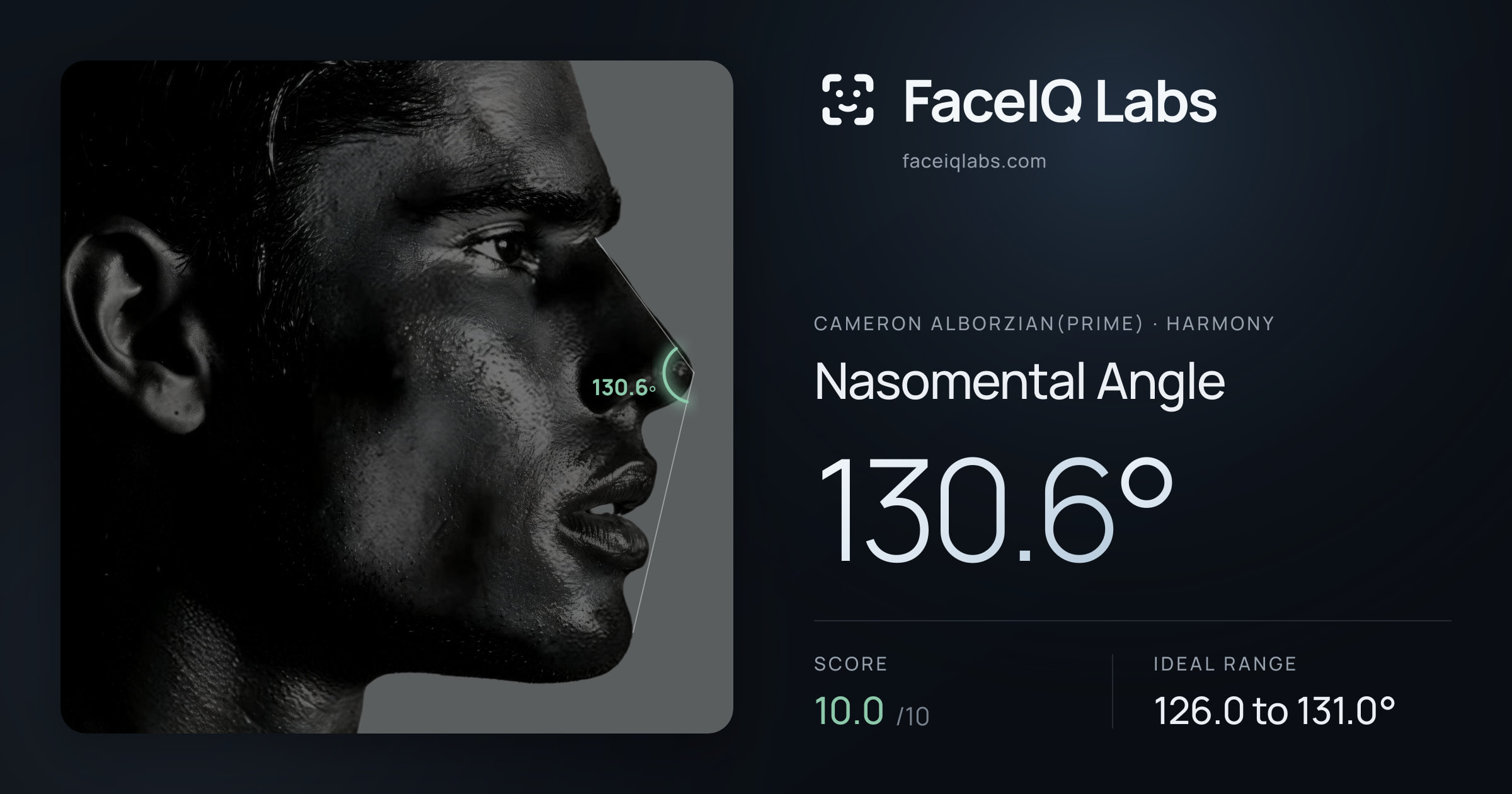 Cameron Alborzian(Prime) Nasomental Angle: 130.6°, drawn on the photo