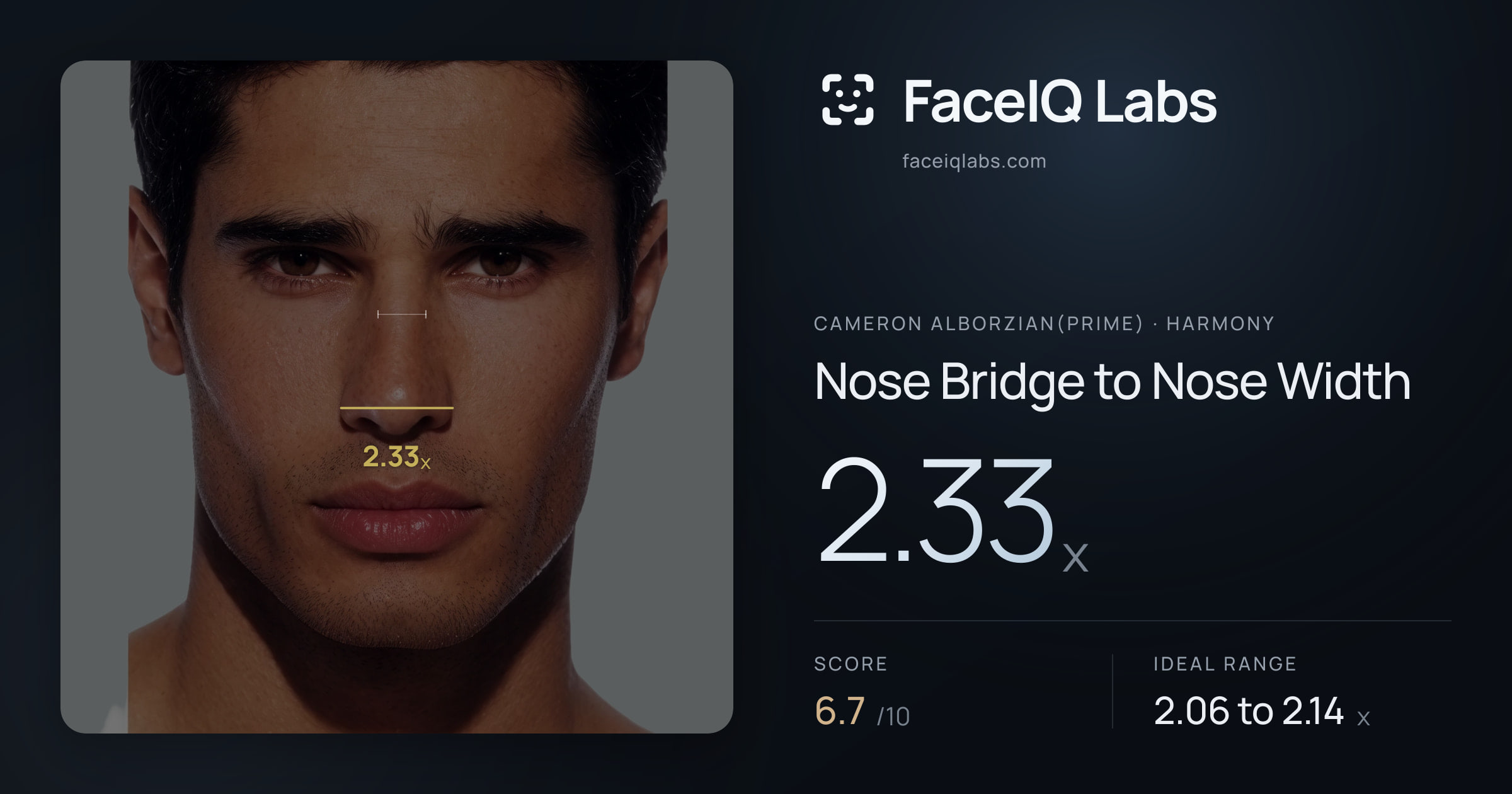 Cameron Alborzian(Prime) Nose Bridge to Nose Width: 2.33x, drawn on the photo