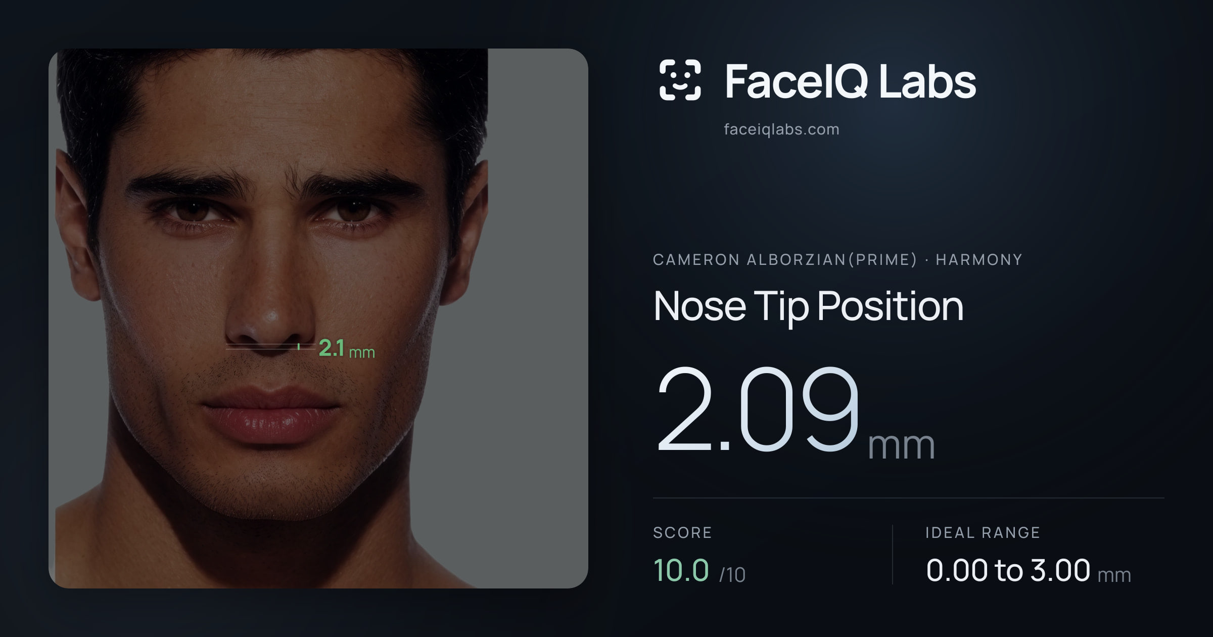 Cameron Alborzian(Prime) Nose Tip Position: 2.09mm, drawn on the photo