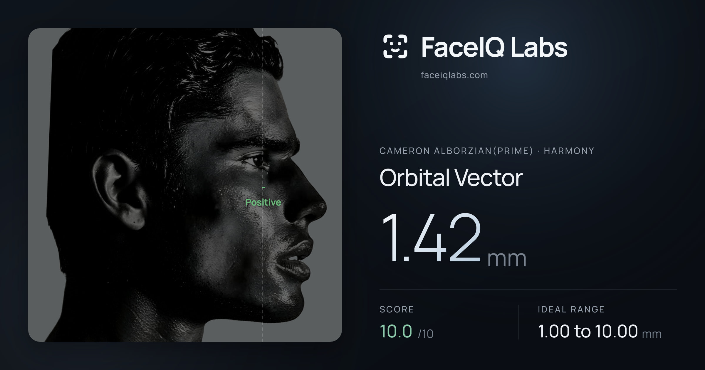 Cameron Alborzian(Prime) Orbital Vector: 1.42mm, drawn on the photo