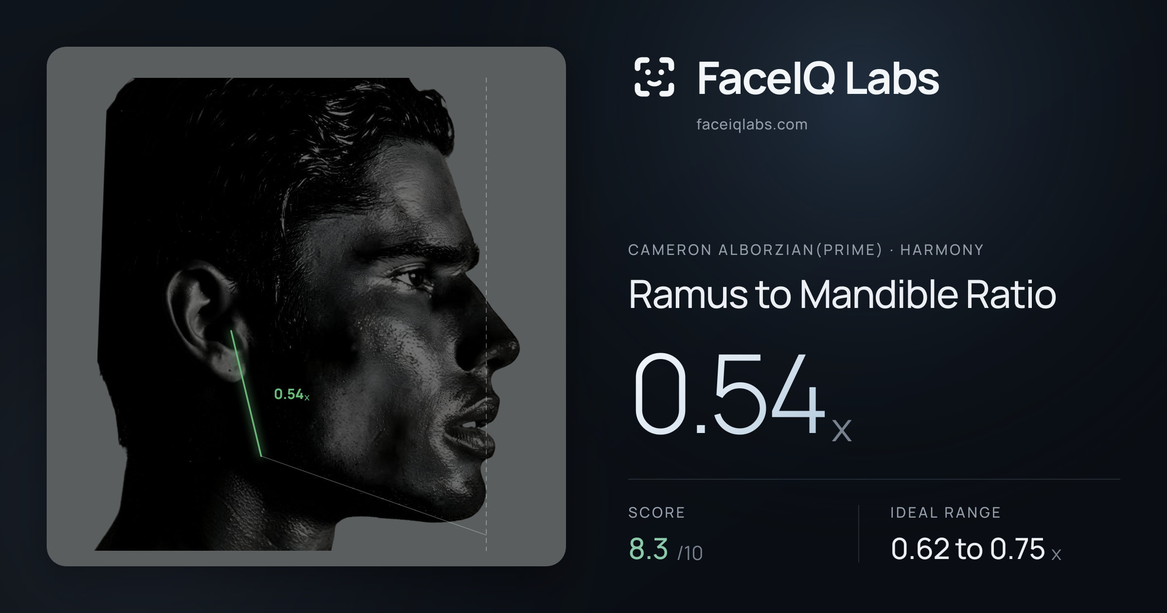 Cameron Alborzian(Prime) Ramus to Mandible Ratio: 0.54x, drawn on the photo