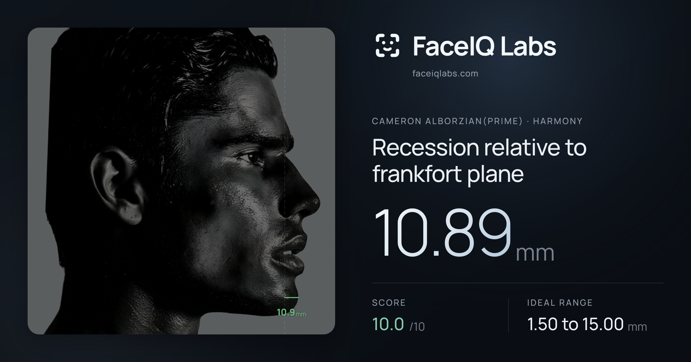 Cameron Alborzian(Prime) Recession relative to frankfort plane: 10.89mm, drawn on the photo
