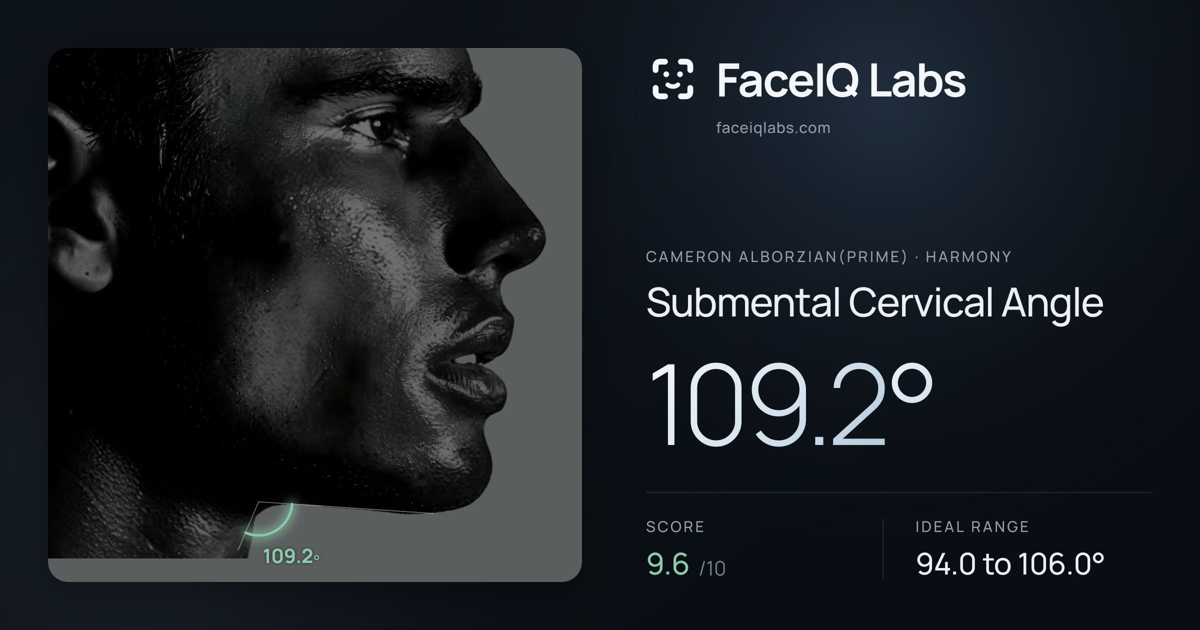 Cameron Alborzian(Prime) Submental Cervical Angle: 109.2°, drawn on the photo