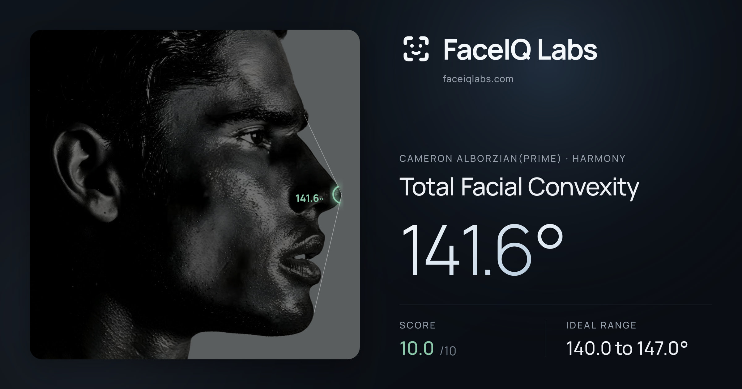 Cameron Alborzian(Prime) Total Facial Convexity: 141.6°, drawn on the photo