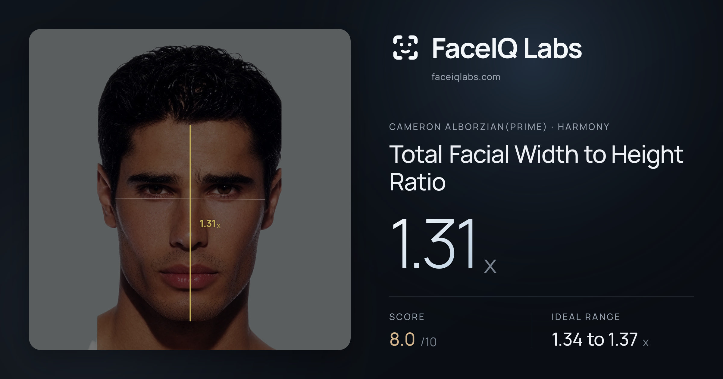 Cameron Alborzian(Prime) Total Facial Width to Height Ratio: 1.31x, drawn on the photo