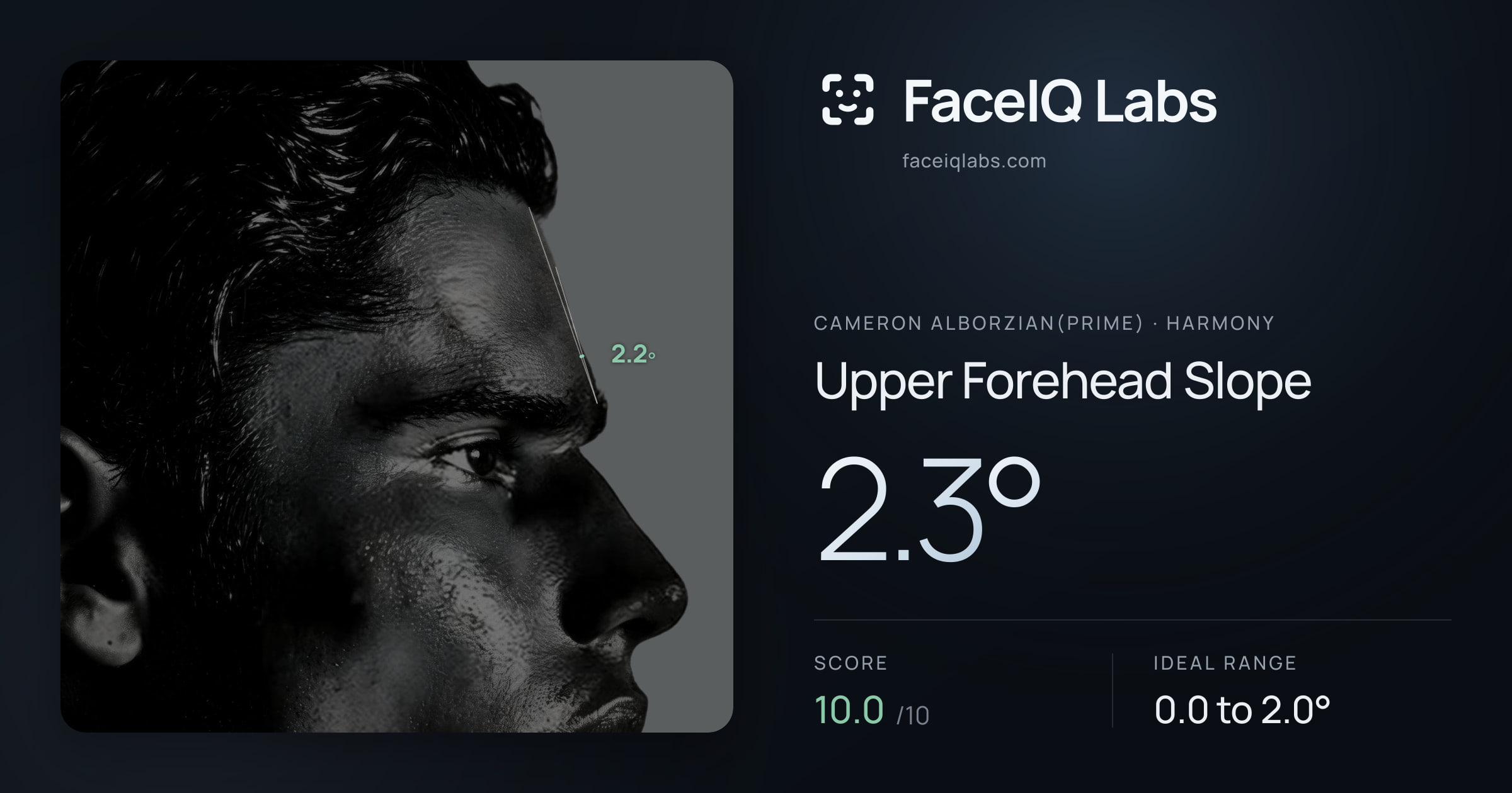 Cameron Alborzian(Prime) Upper Forehead Slope: 2.3°, drawn on the photo