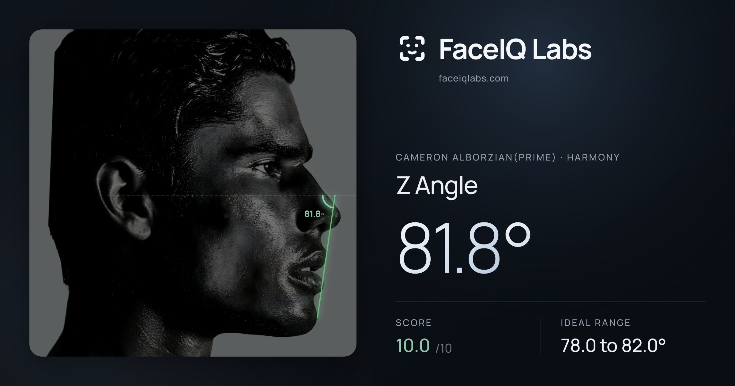 Cameron Alborzian(Prime) Z Angle: 81.8°, drawn on the photo