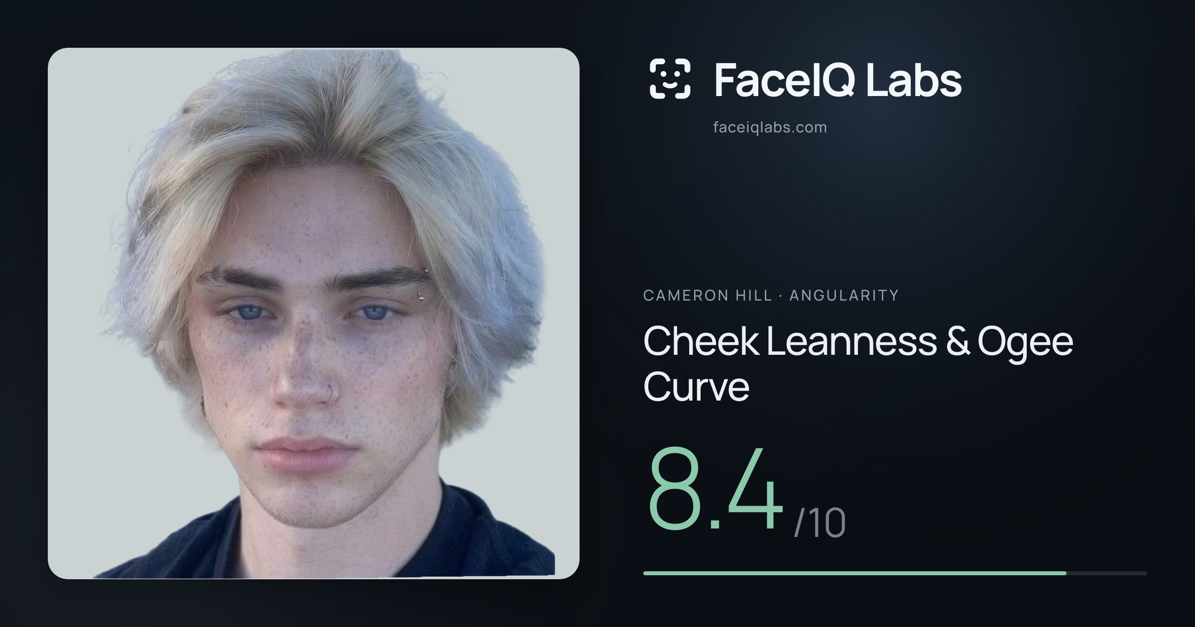 Cameron Hill Cheek Leanness & Ogee Curve: 8.4/10, drawn on the photo