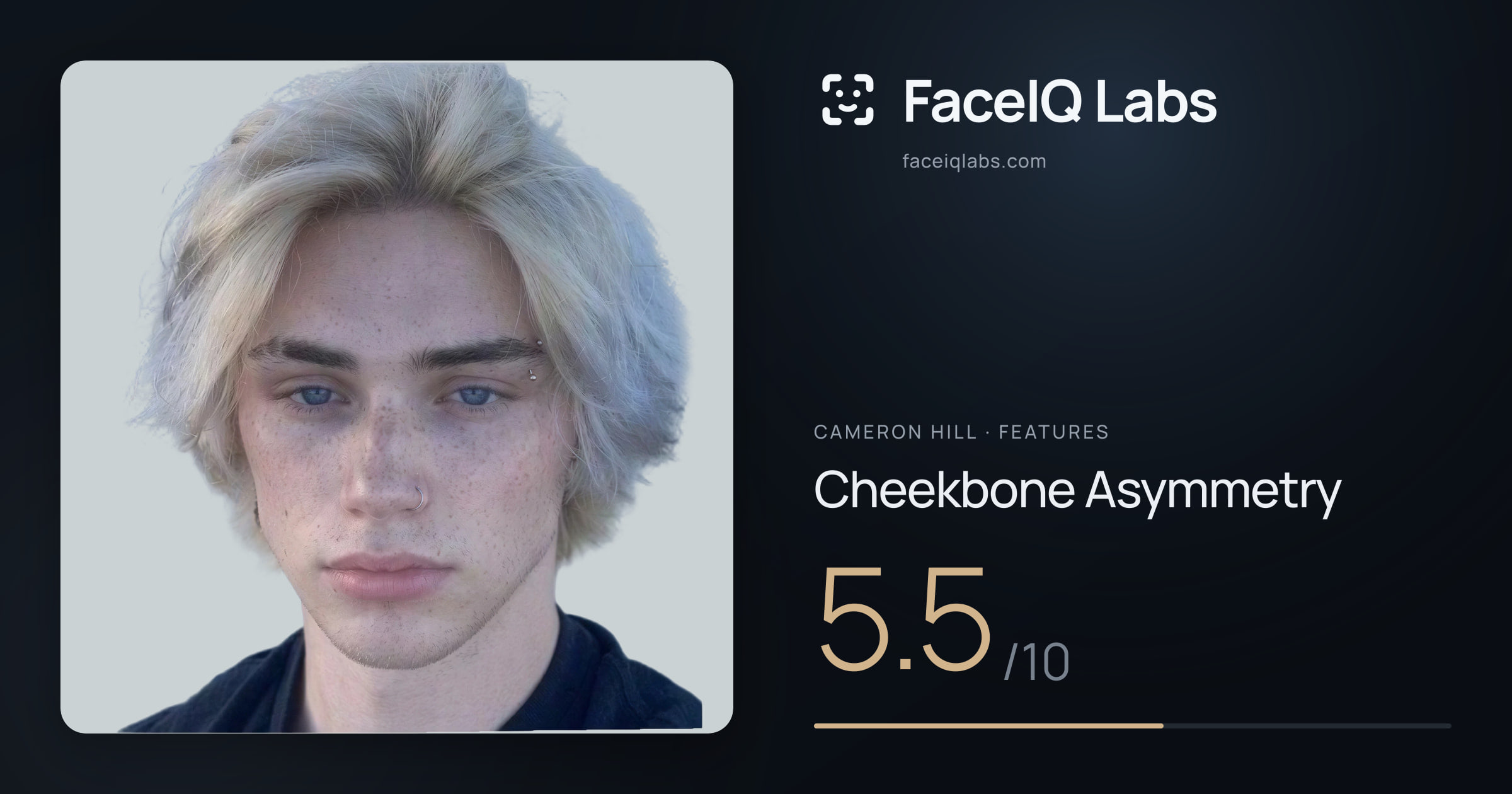 Cameron Hill Cheekbone Asymmetry: 5.5/10, drawn on the photo