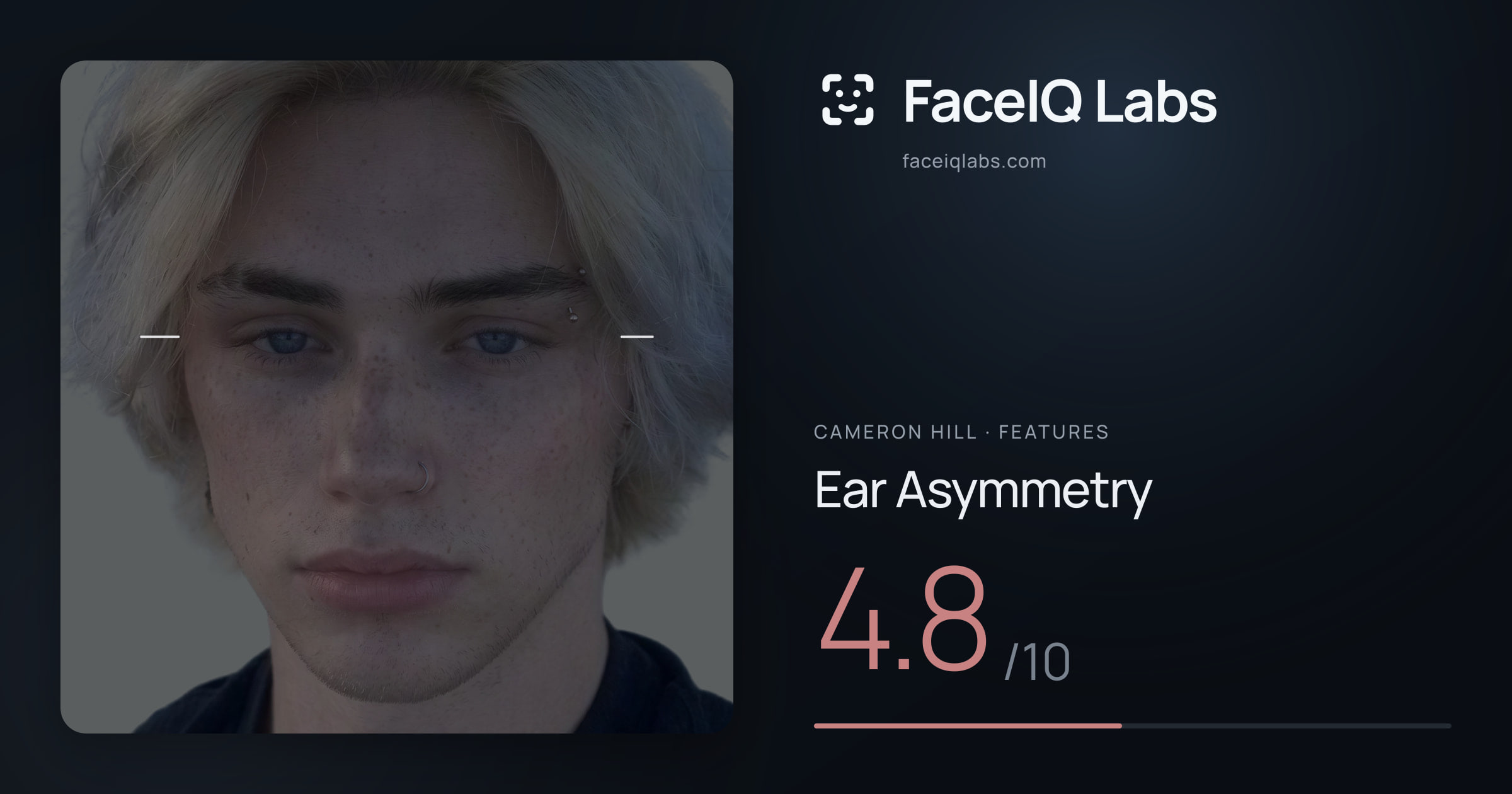 Cameron Hill Ear Asymmetry: 4.8/10, drawn on the photo