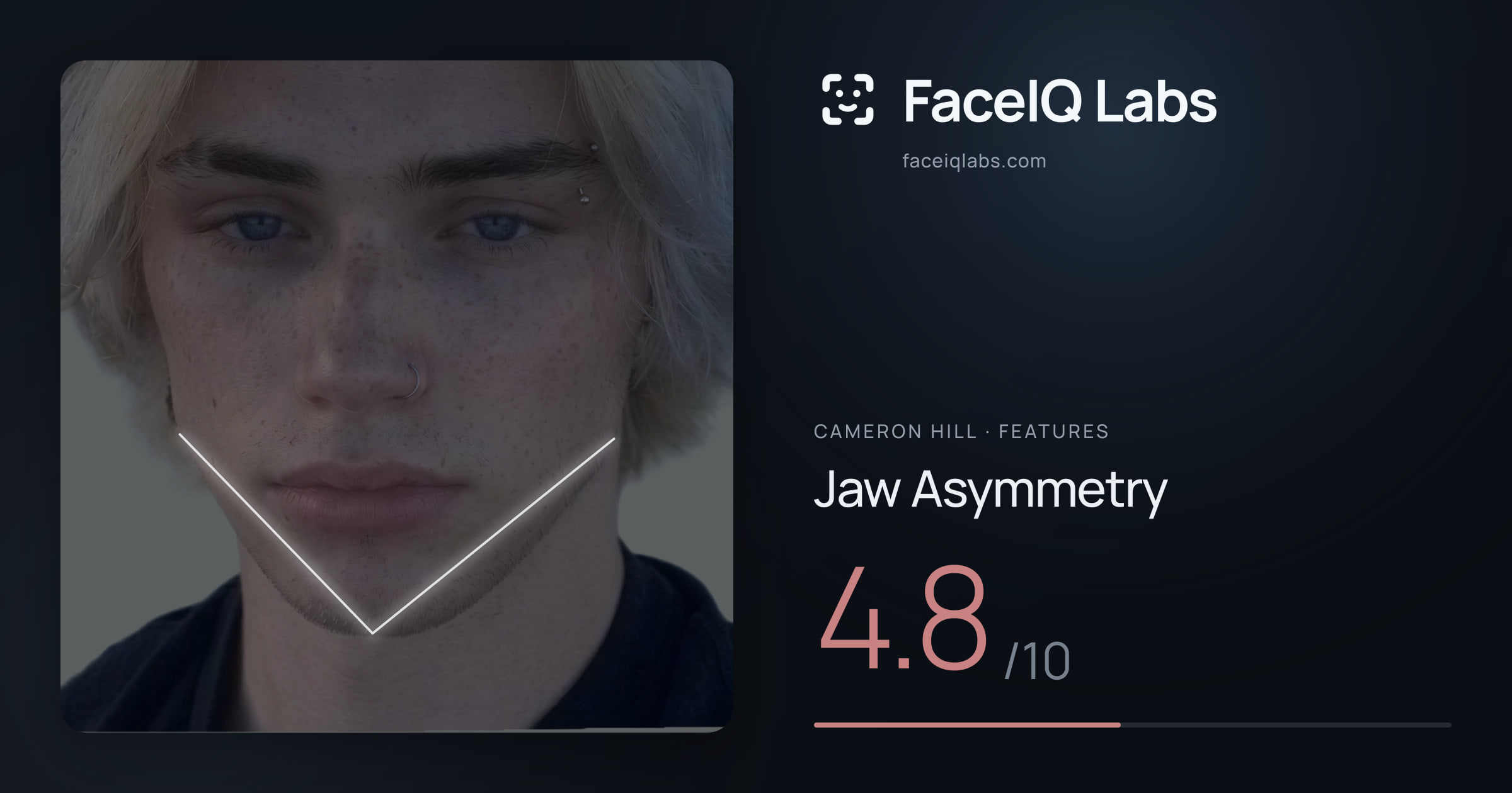 Cameron Hill Jaw Asymmetry: 4.8/10, drawn on the photo