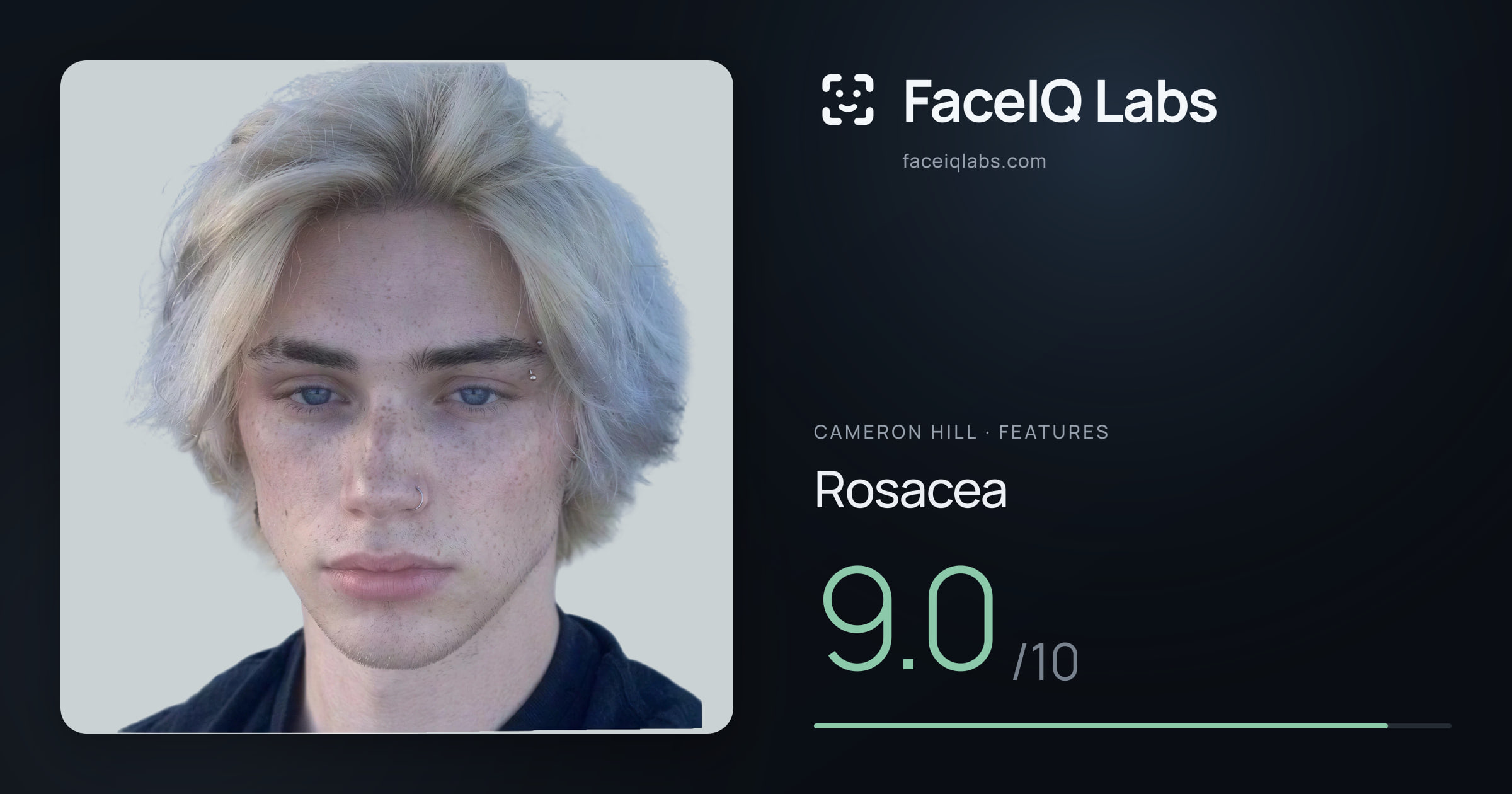 Cameron Hill Rosacea: 9.0/10, drawn on the photo