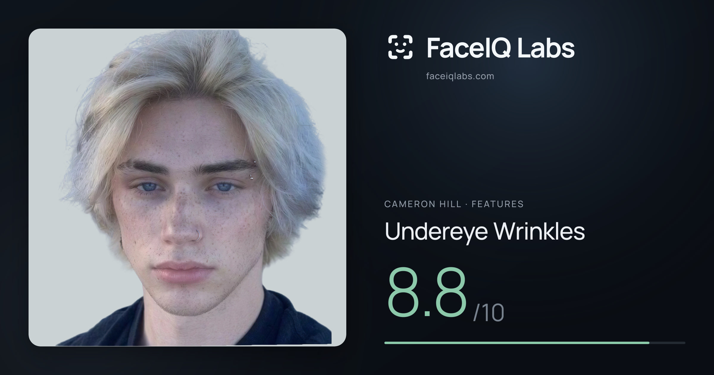 Cameron Hill Undereye Wrinkles: 8.8/10, drawn on the photo