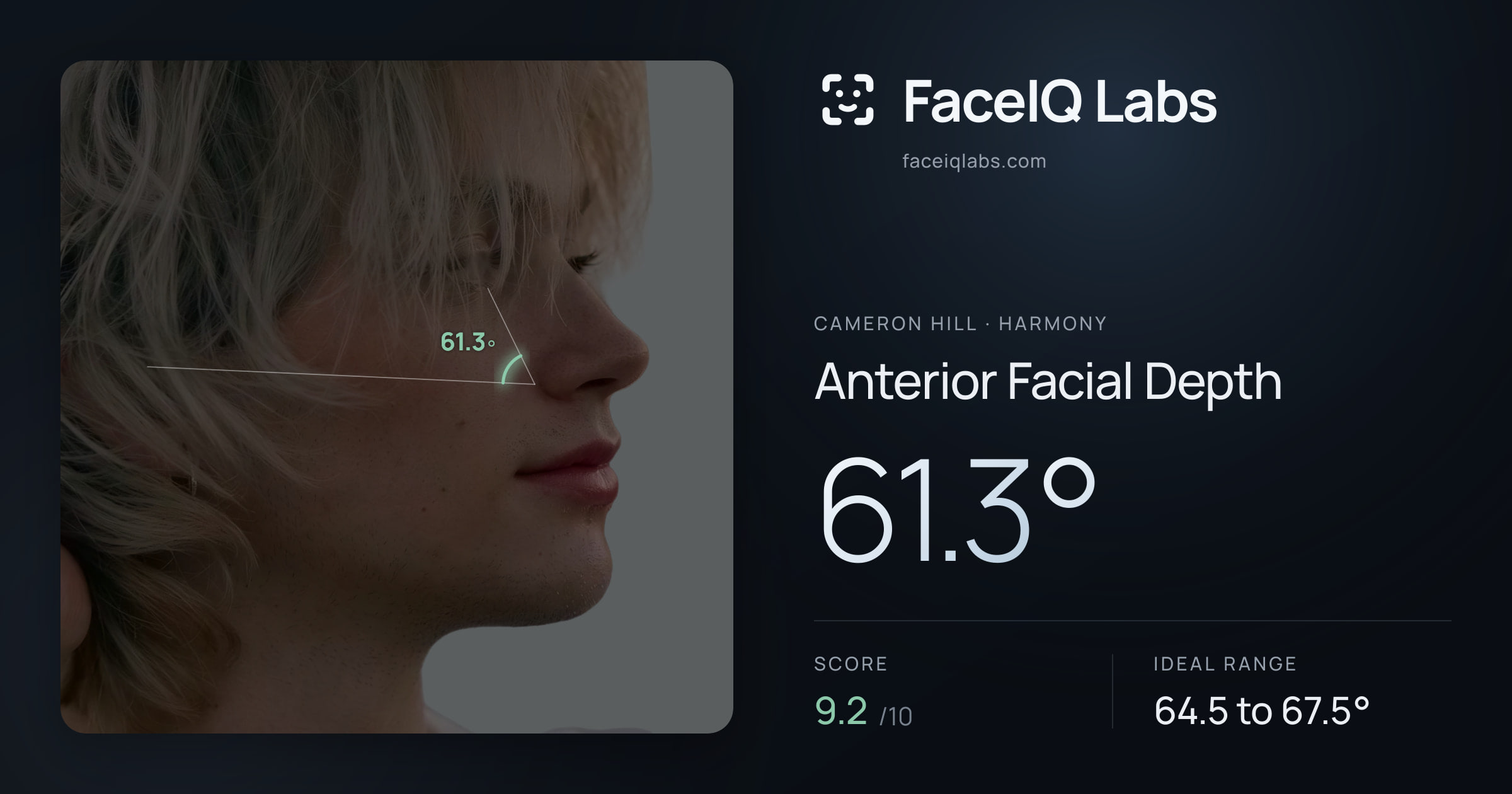 Cameron Hill Anterior Facial Depth: 61.3°, drawn on the photo