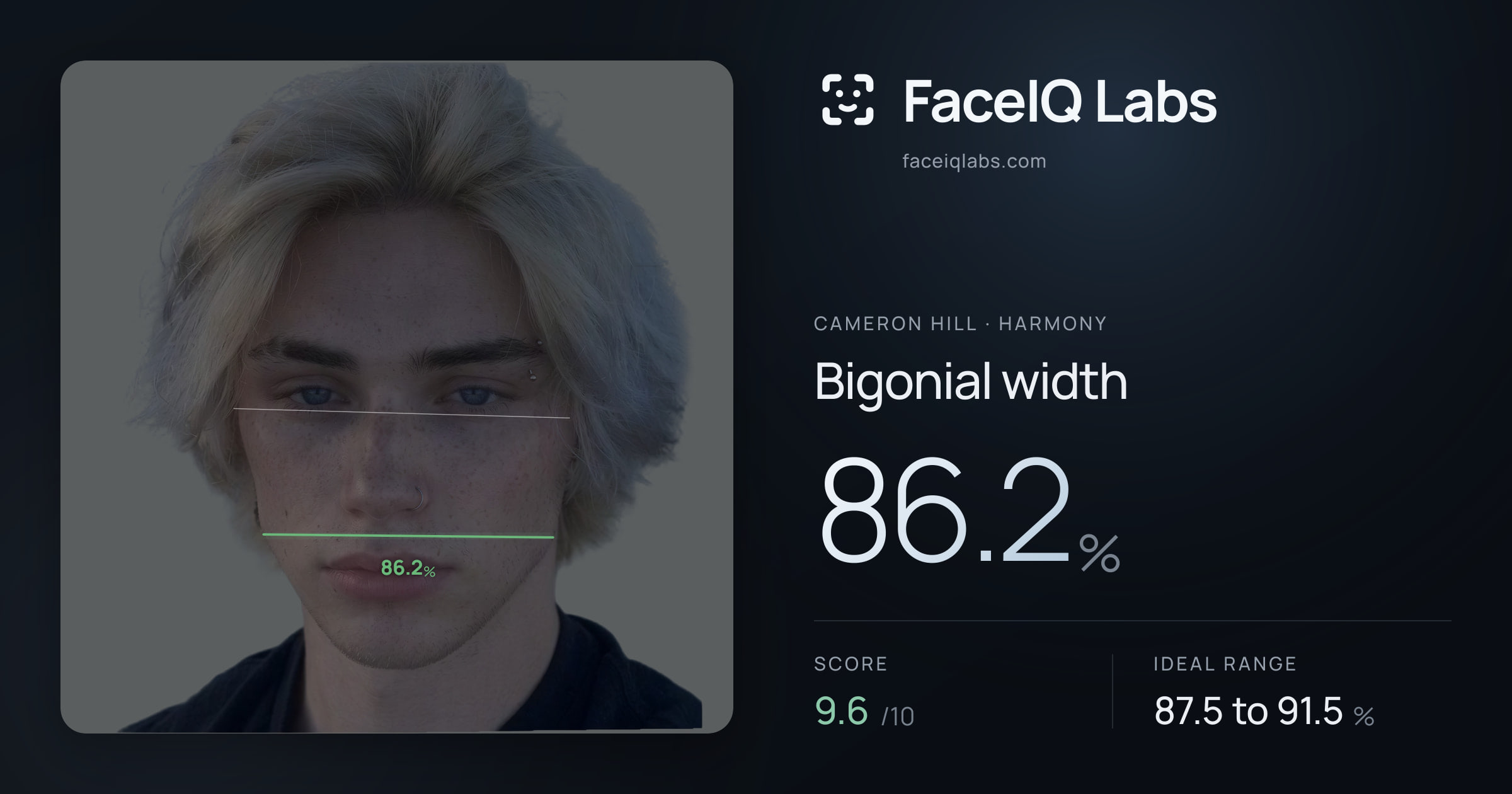 Cameron Hill Bigonial width: 86.2%, drawn on the photo
