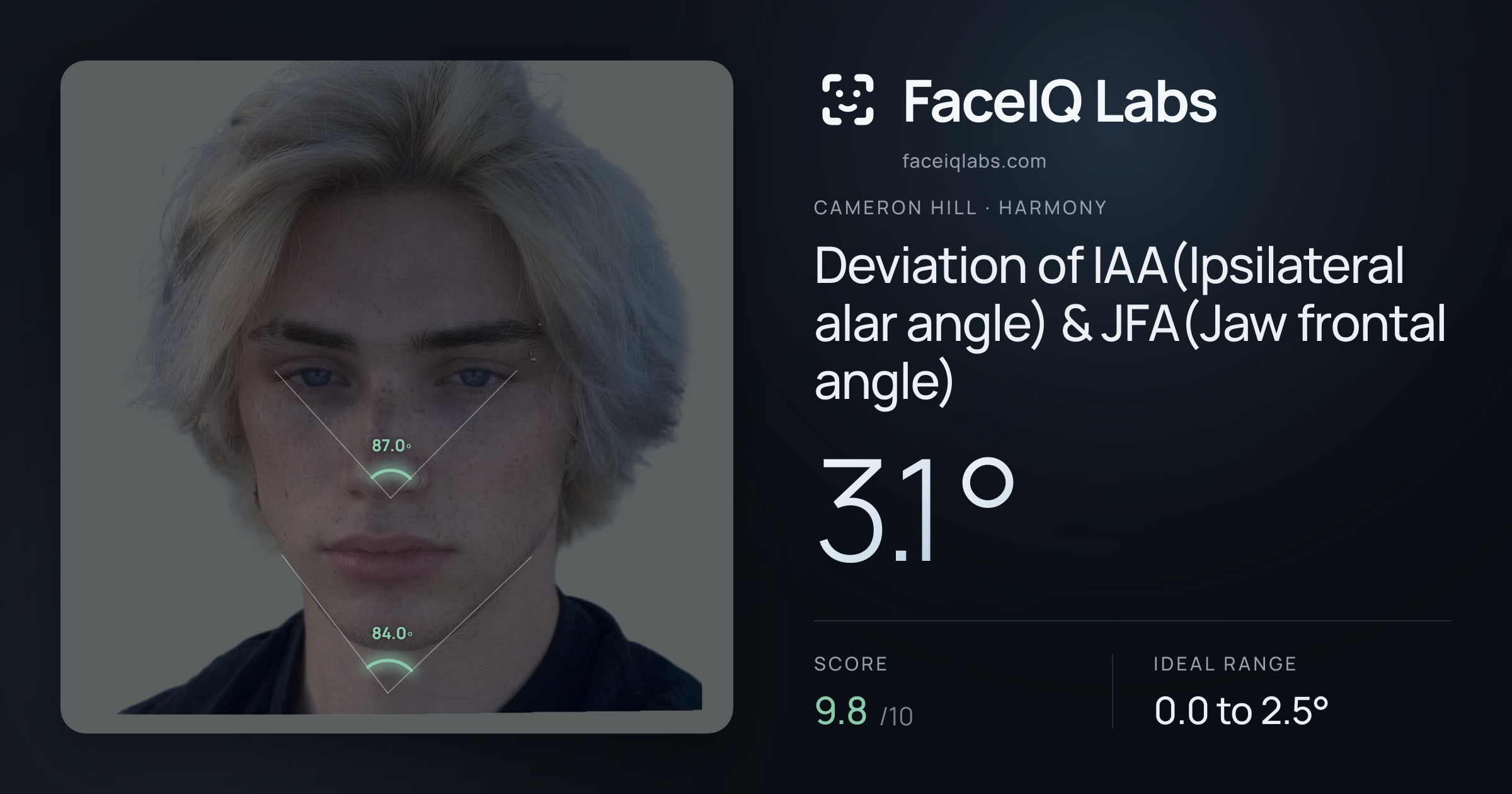Cameron Hill Deviation of IAA(Ipsilateral alar angle) & JFA(Jaw frontal angle): 3.1°, drawn on the photo