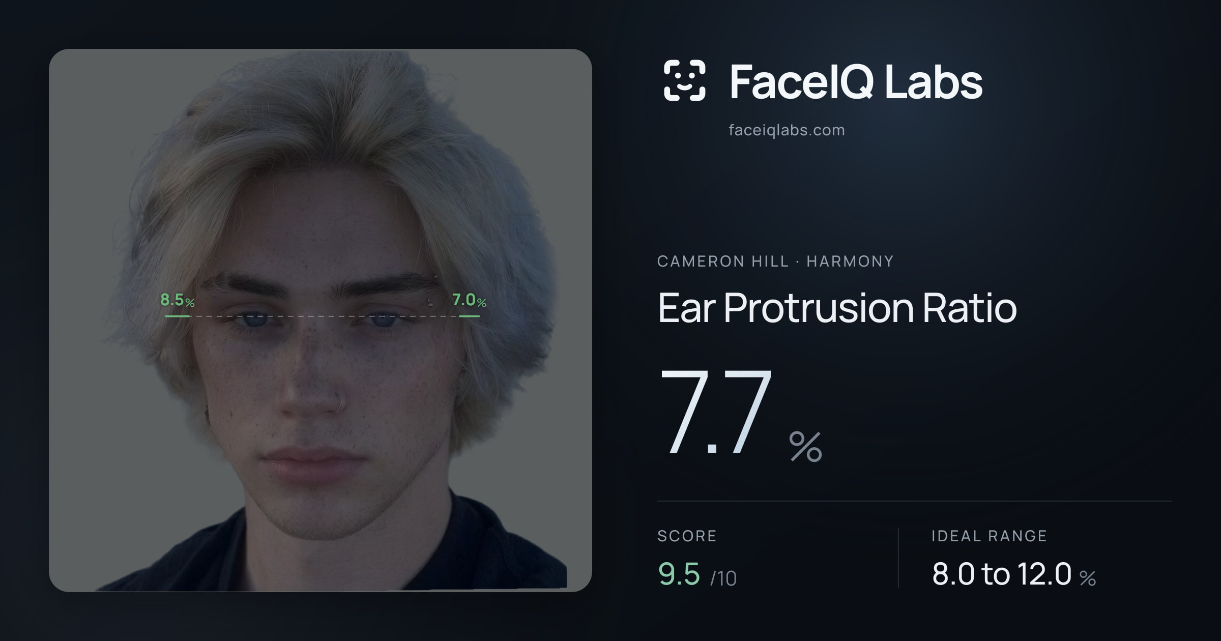 Cameron Hill Ear Protrusion Ratio: 7.7%, drawn on the photo