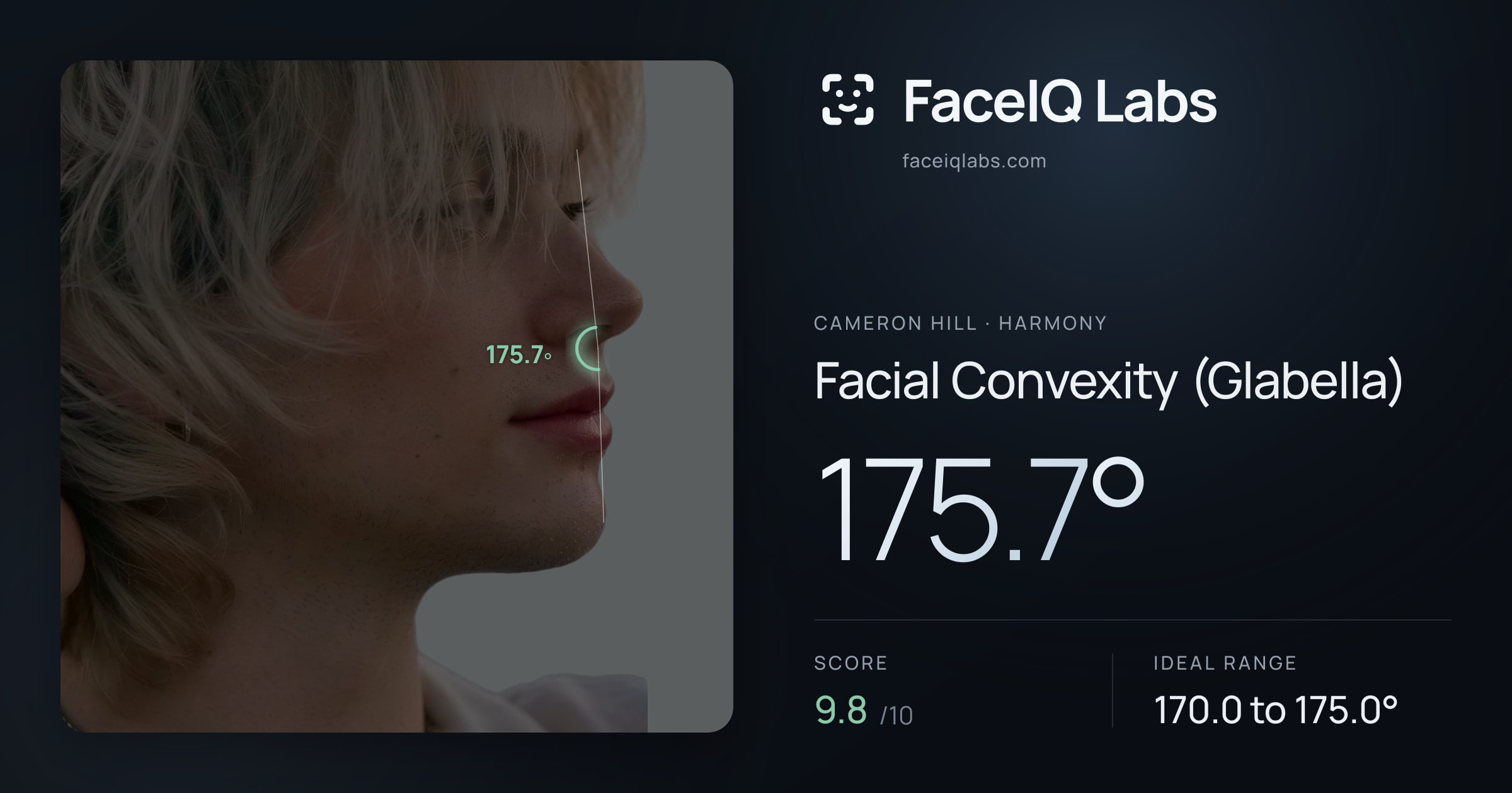 Cameron Hill Facial Convexity (Glabella): 175.7°, drawn on the photo