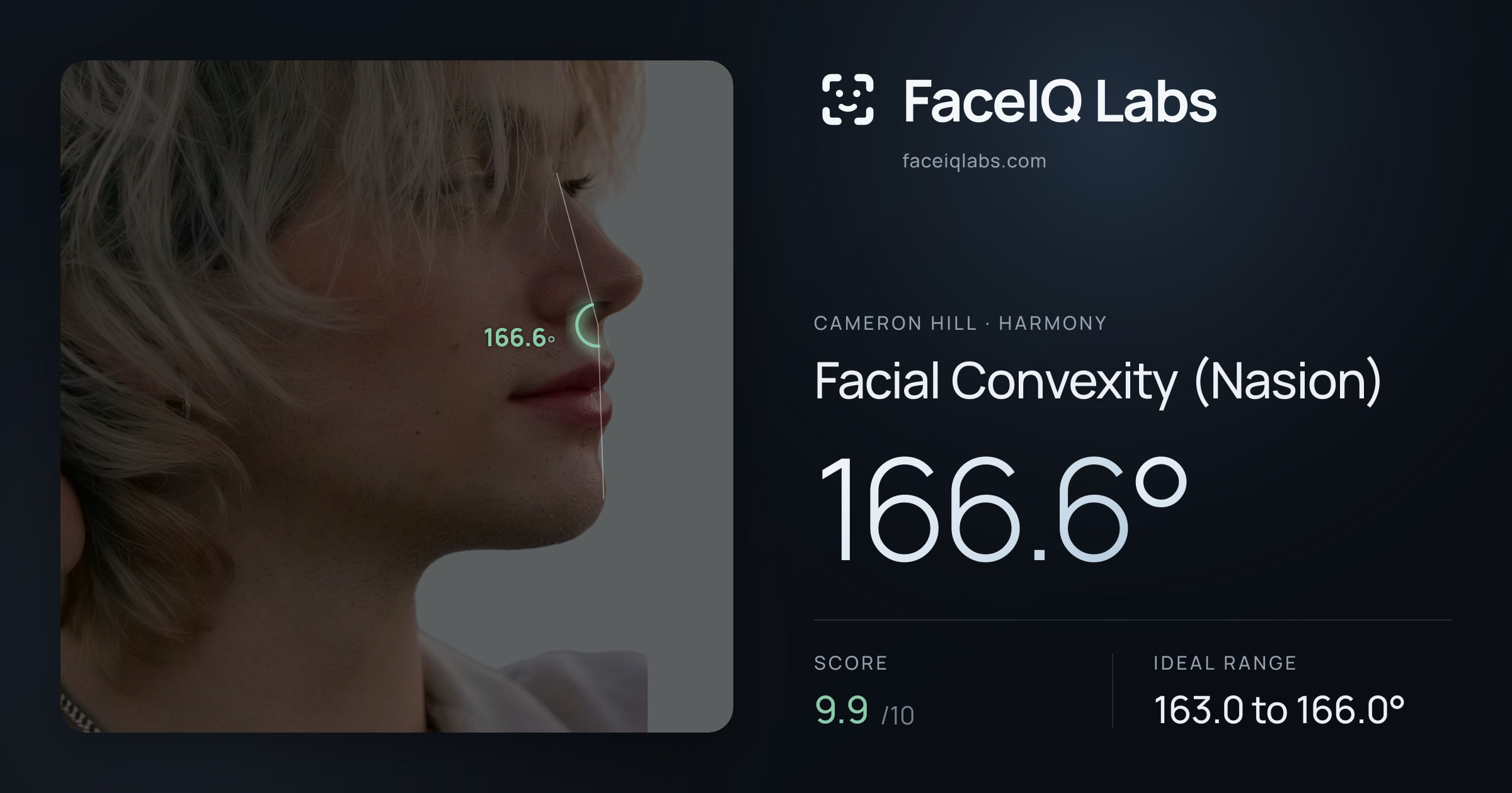 Cameron Hill Facial Convexity (Nasion): 166.6°, drawn on the photo