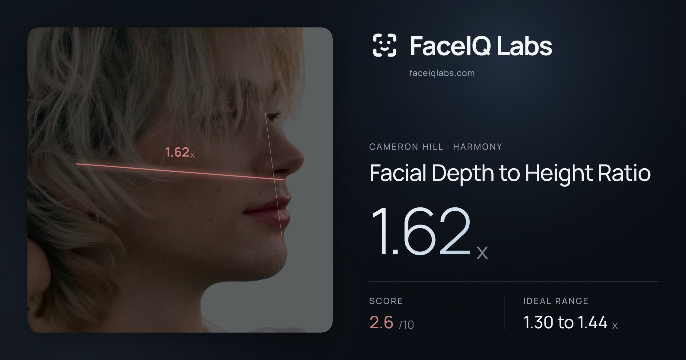 Cameron Hill Facial Depth to Height Ratio: 1.62x, drawn on the photo