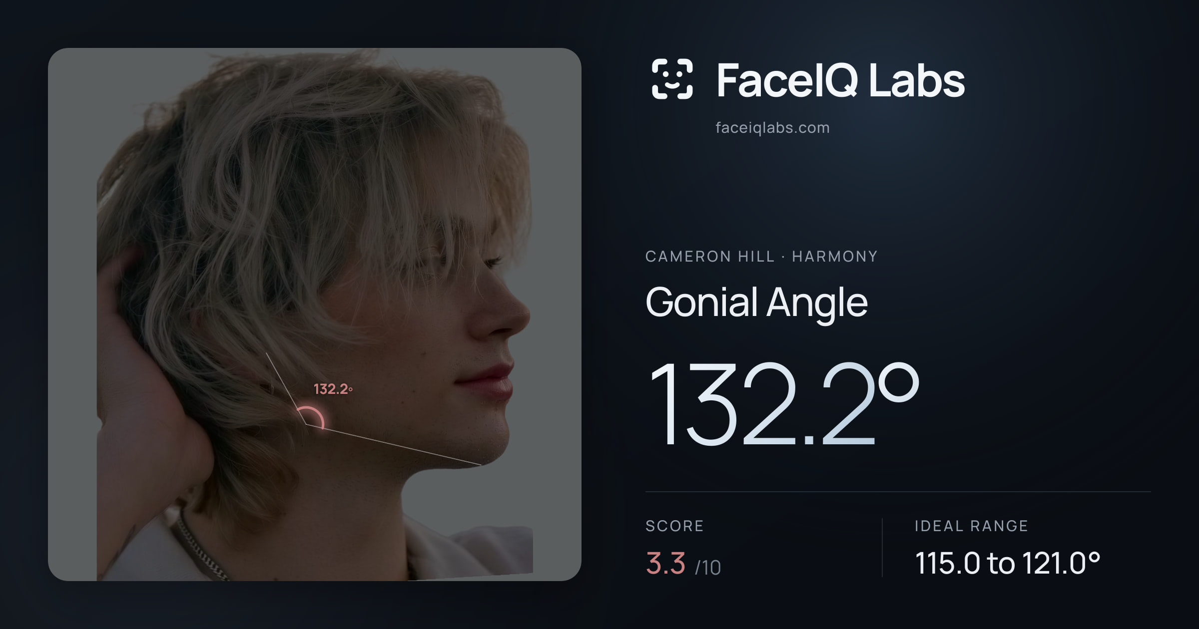 Cameron Hill Gonial Angle: 132.2°, drawn on the photo