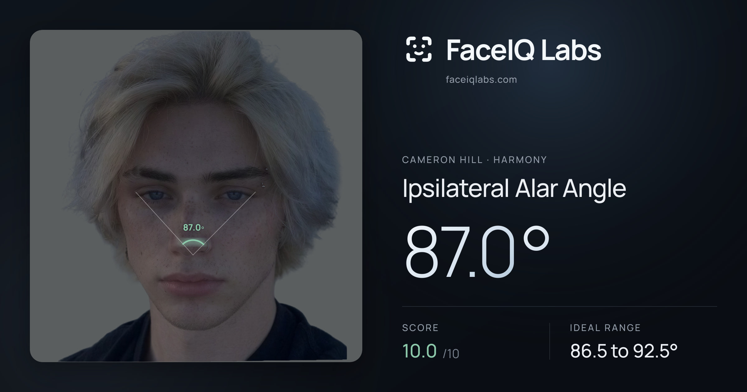 Cameron Hill Ipsilateral Alar Angle: 87.0°, drawn on the photo