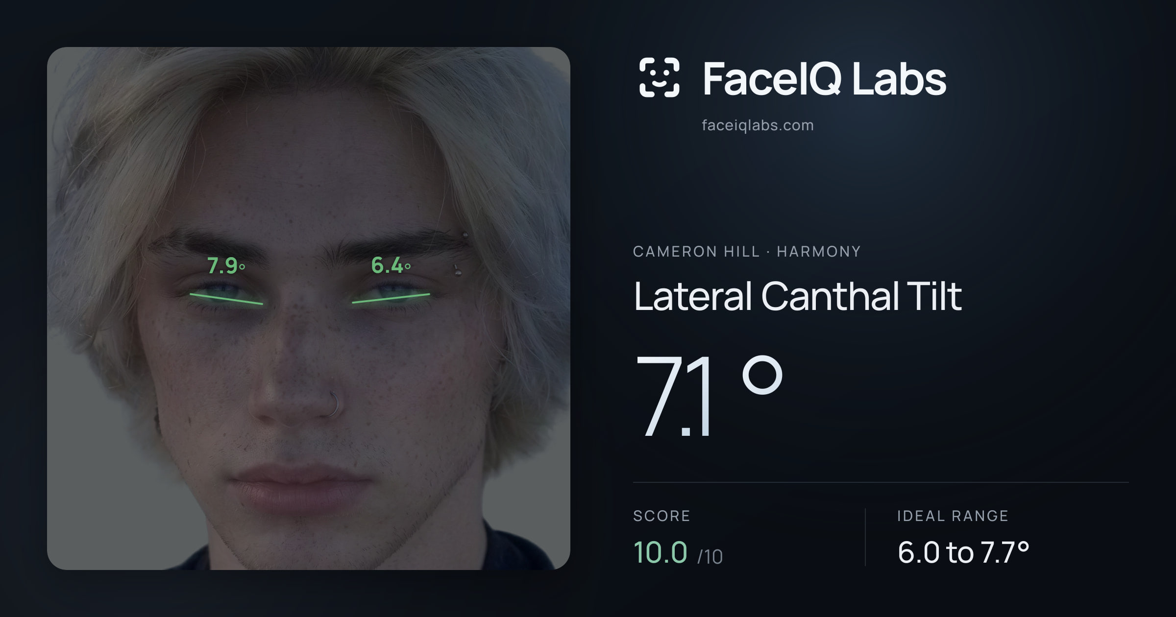 Cameron Hill Lateral Canthal Tilt: 7.1°, drawn on the photo