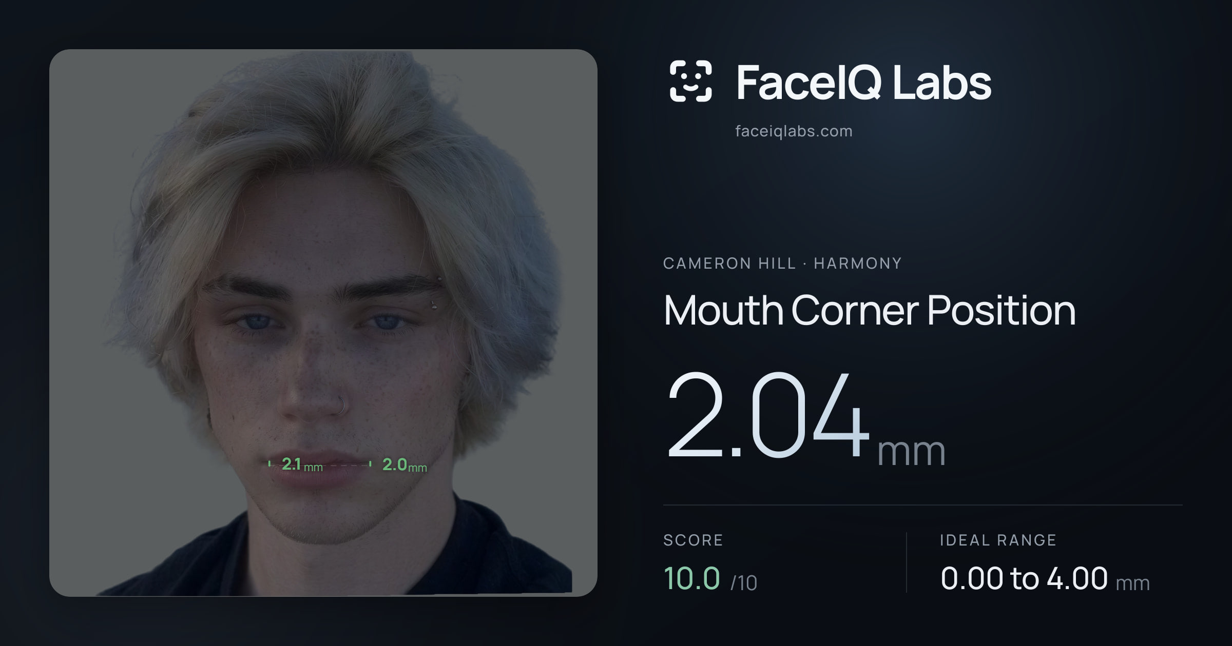 Cameron Hill Mouth Corner Position: 2.04mm, drawn on the photo