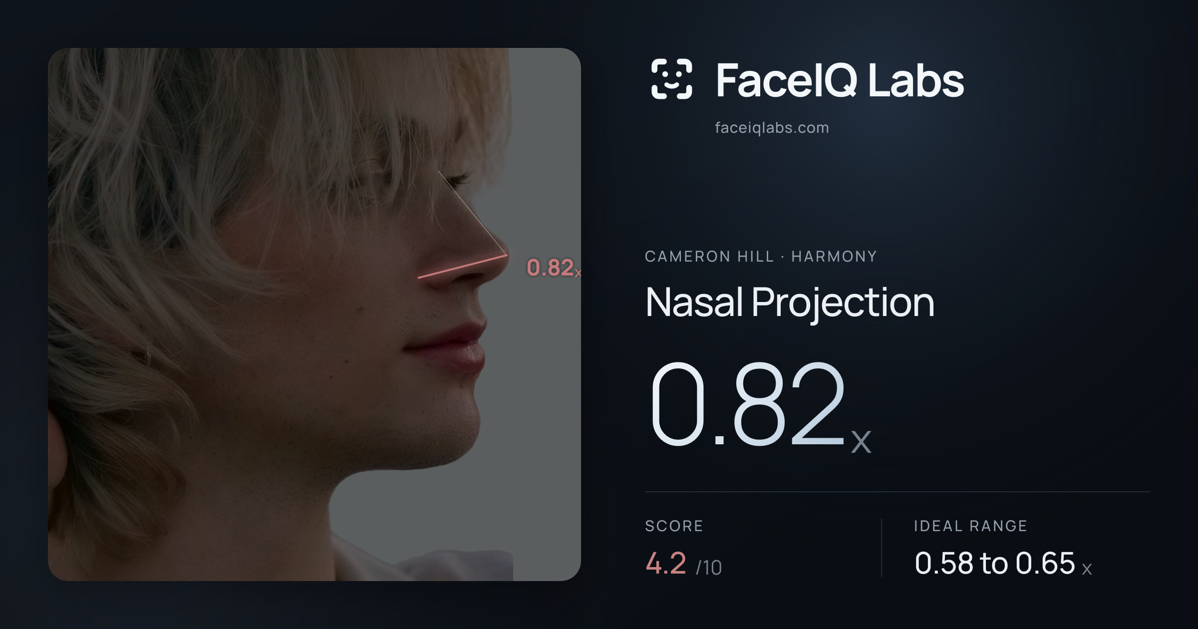 Cameron Hill Nasal Projection: 0.82x, drawn on the photo