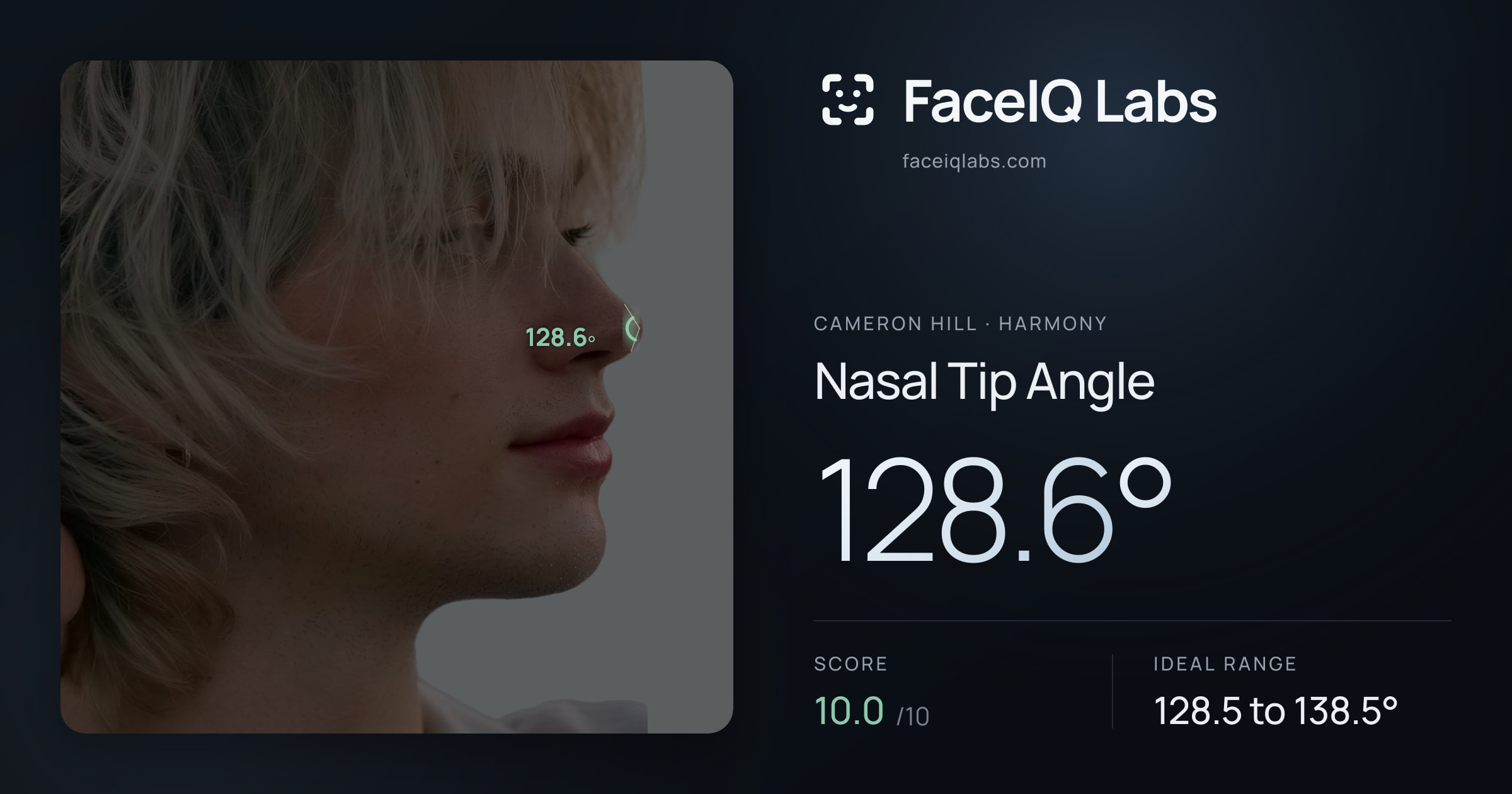 Cameron Hill Nasal Tip Angle: 128.6°, drawn on the photo