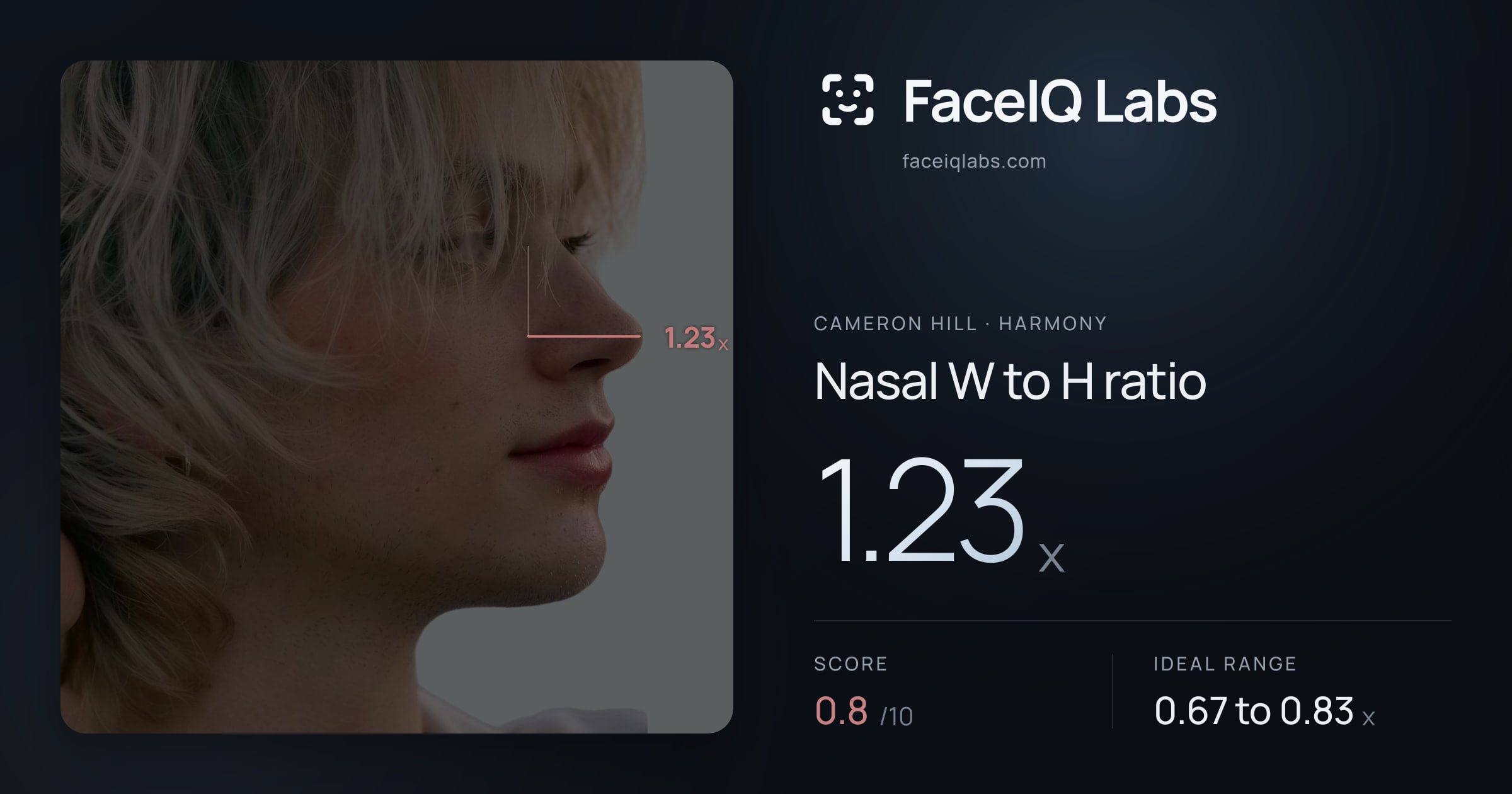 Cameron Hill Nasal W to H ratio: 1.23x, drawn on the photo