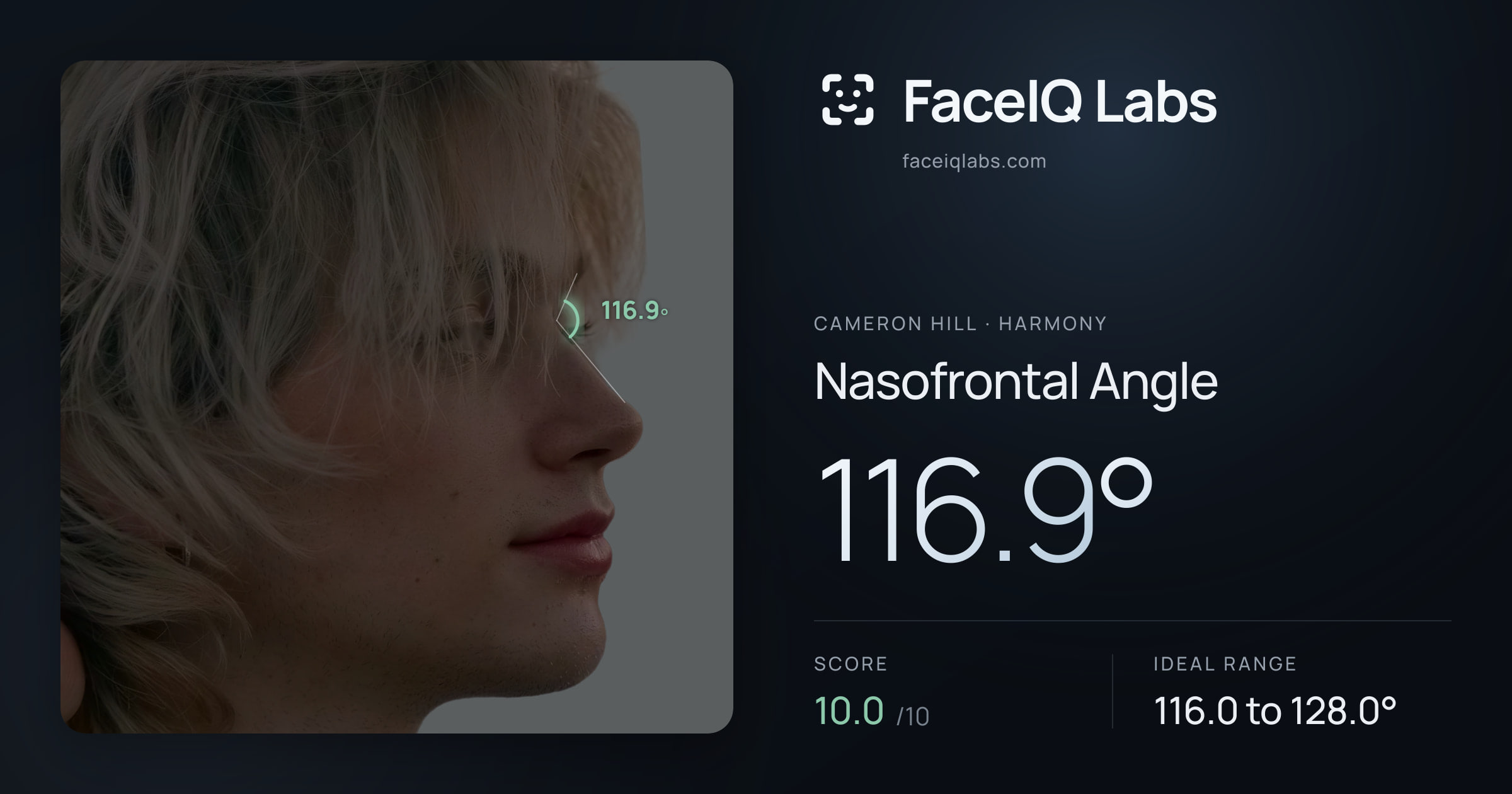 Cameron Hill Nasofrontal Angle: 116.9°, drawn on the photo