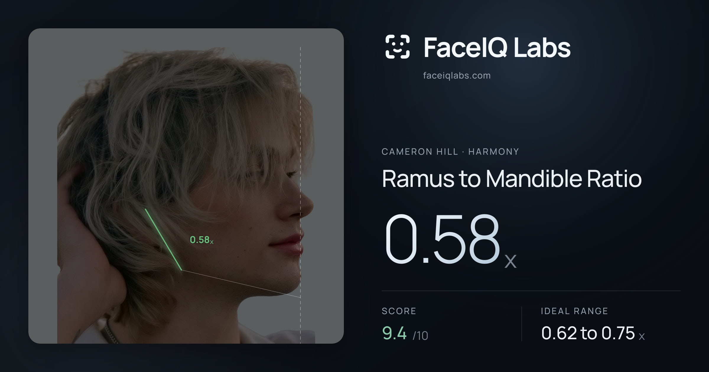 Cameron Hill Ramus to Mandible Ratio: 0.58x, drawn on the photo