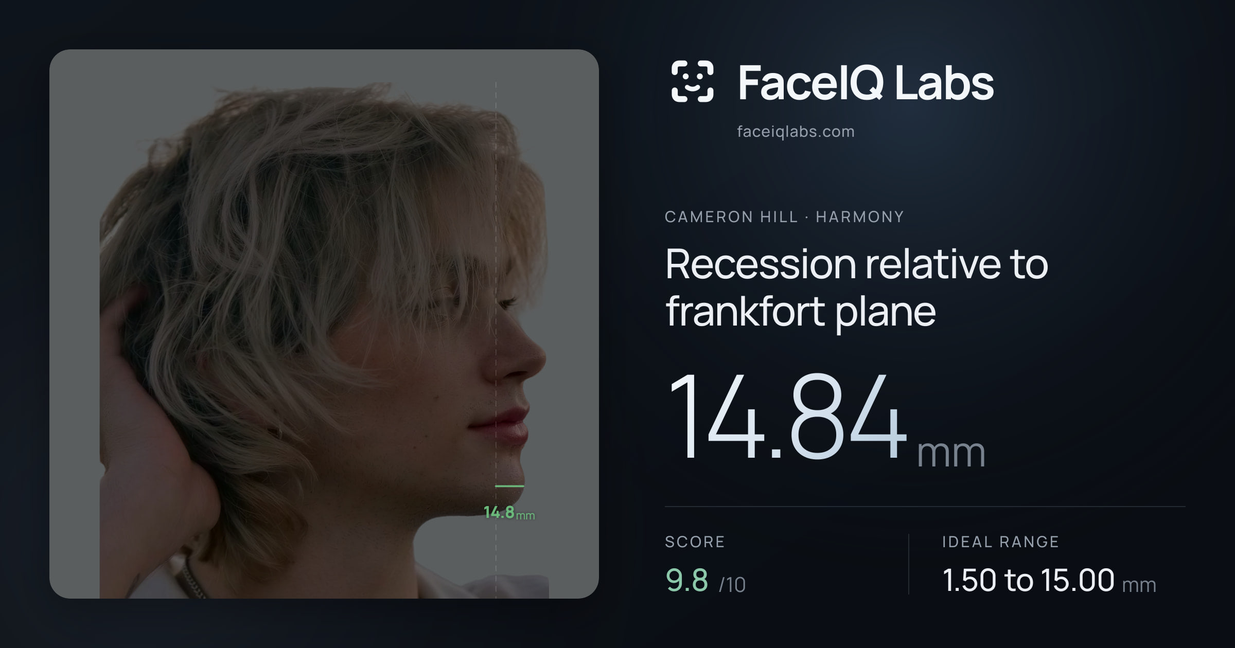 Cameron Hill Recession relative to frankfort plane: 14.84mm, drawn on the photo