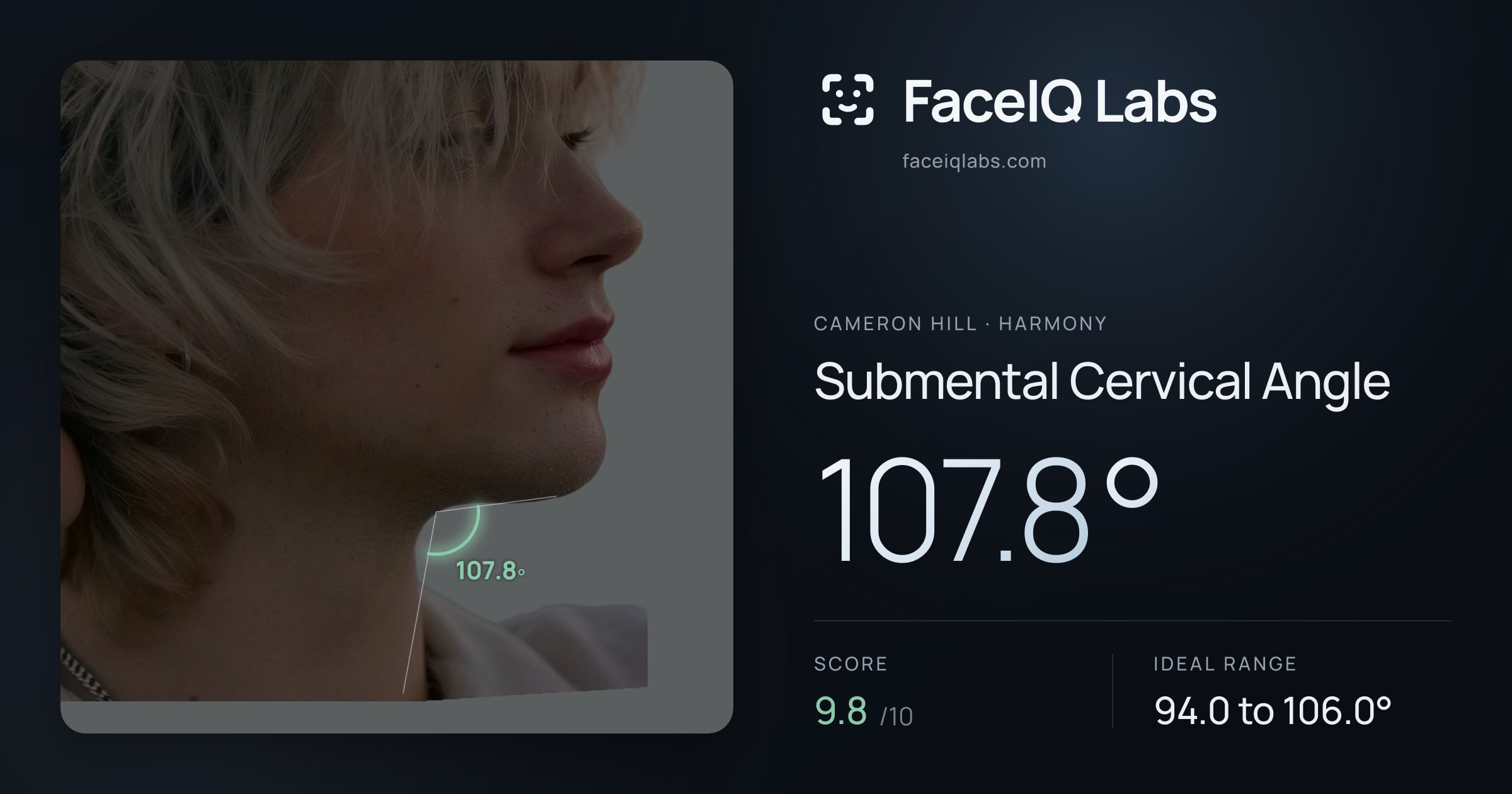 Cameron Hill Submental Cervical Angle: 107.8°, drawn on the photo
