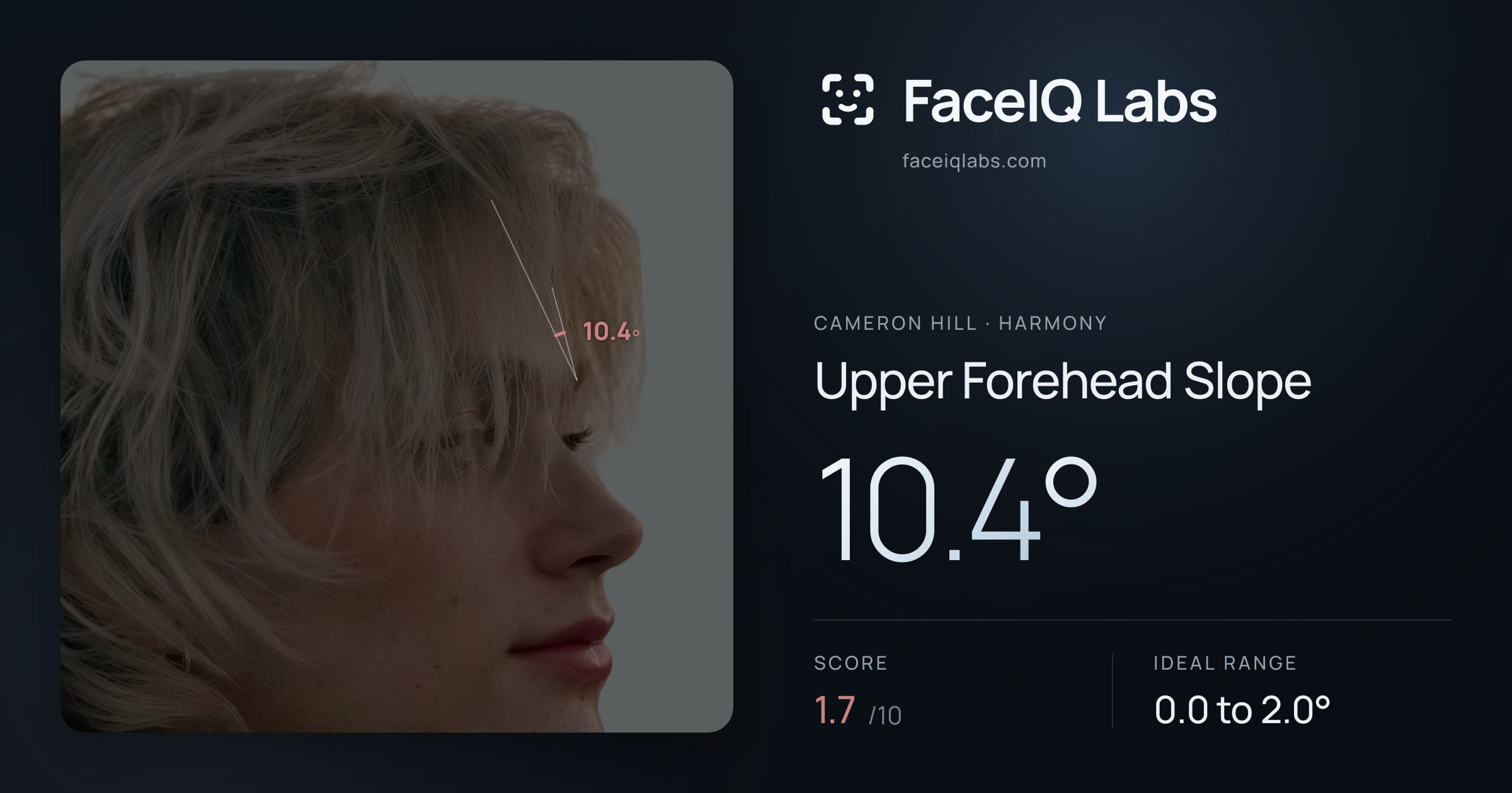 Cameron Hill Upper Forehead Slope: 10.4°, drawn on the photo