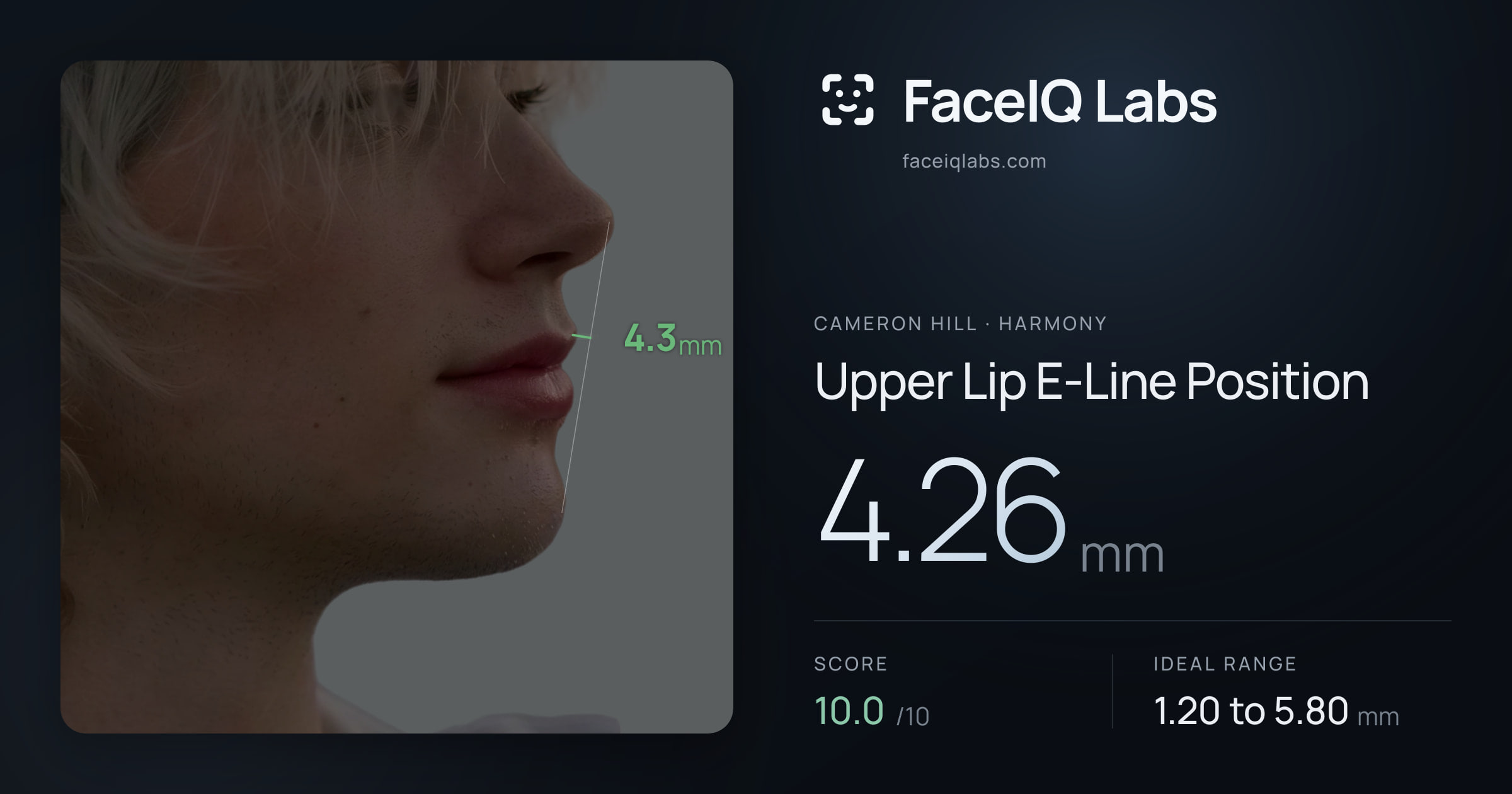 Cameron Hill Upper Lip E-Line Position: 4.26mm, drawn on the photo