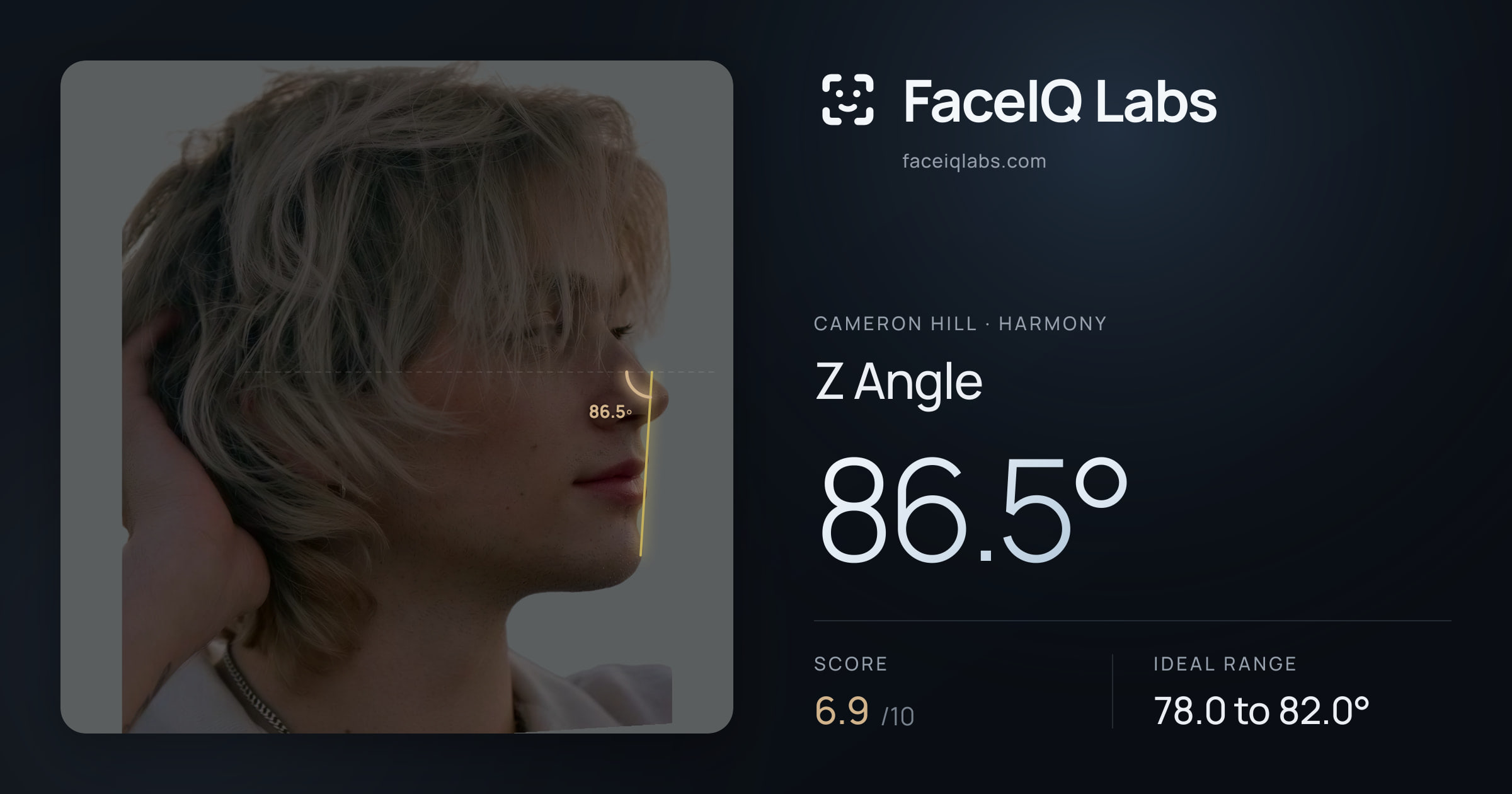 Cameron Hill Z Angle: 86.5°, drawn on the photo