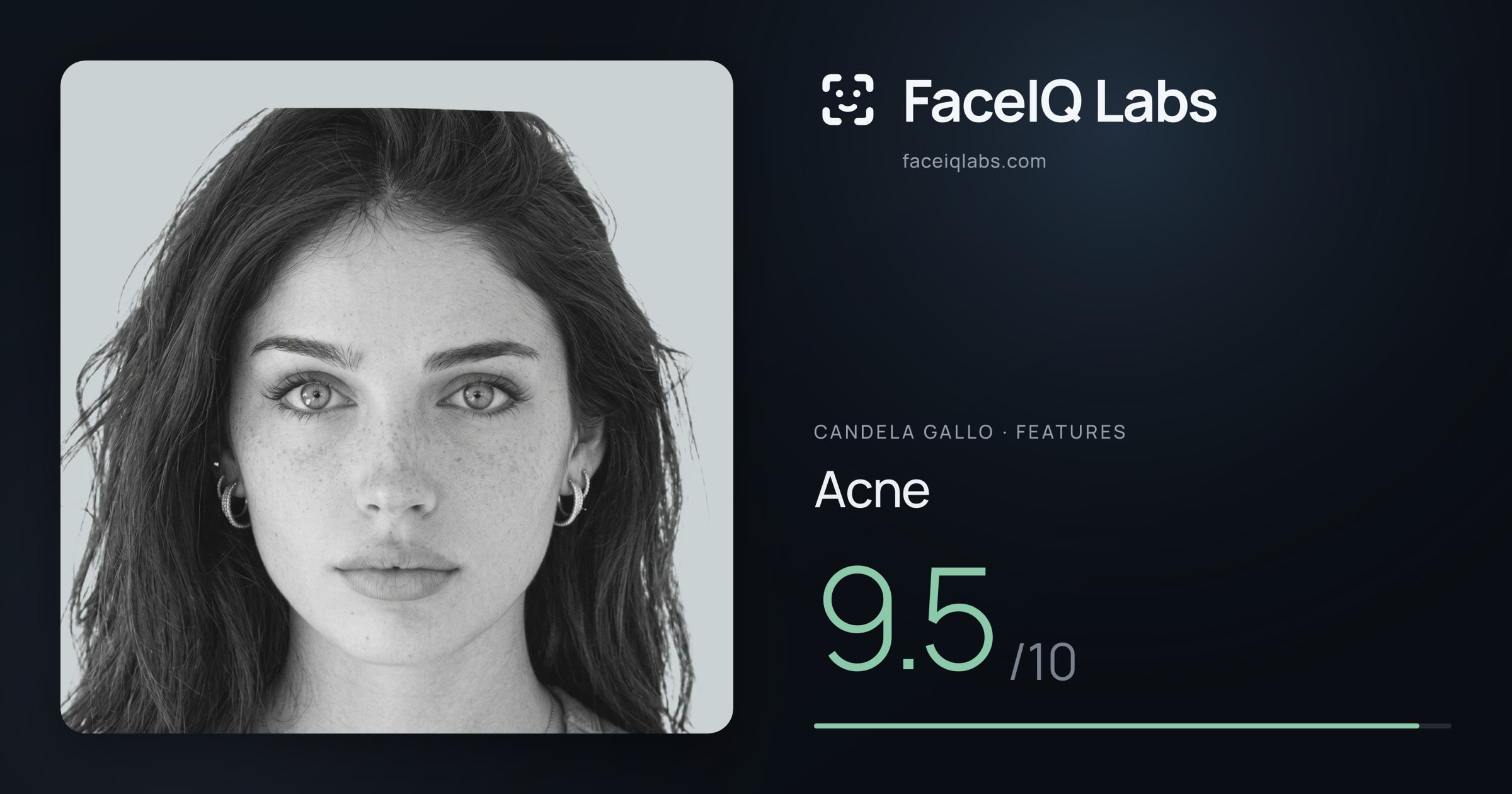 Candela Gallo Acne: 9.5/10, drawn on the photo