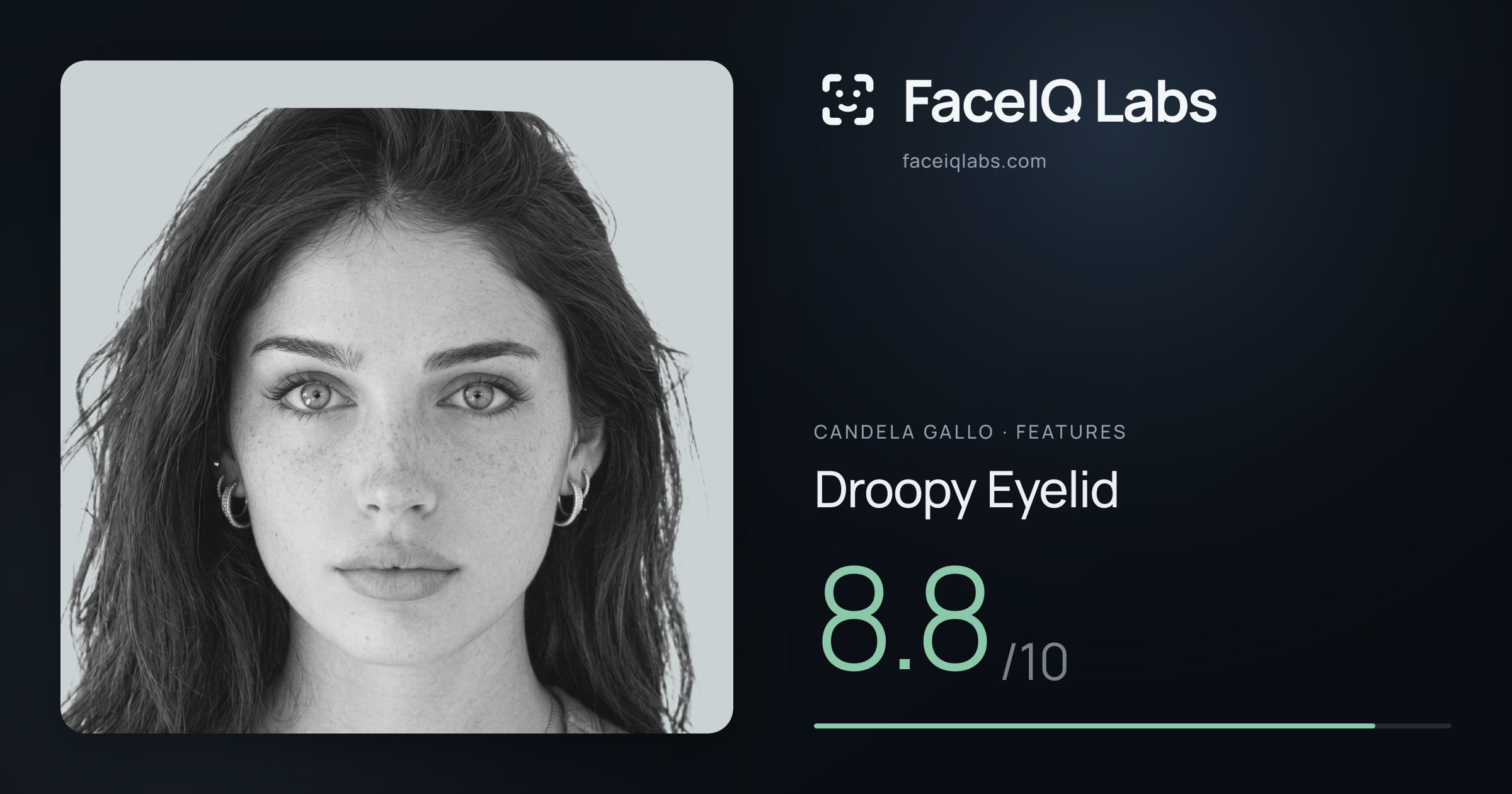 Candela Gallo Droopy Eyelid: 8.8/10, drawn on the photo