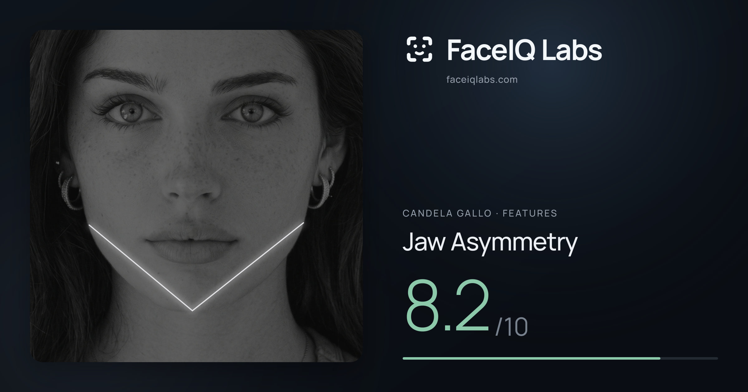 Candela Gallo Jaw Asymmetry: 8.2/10, drawn on the photo