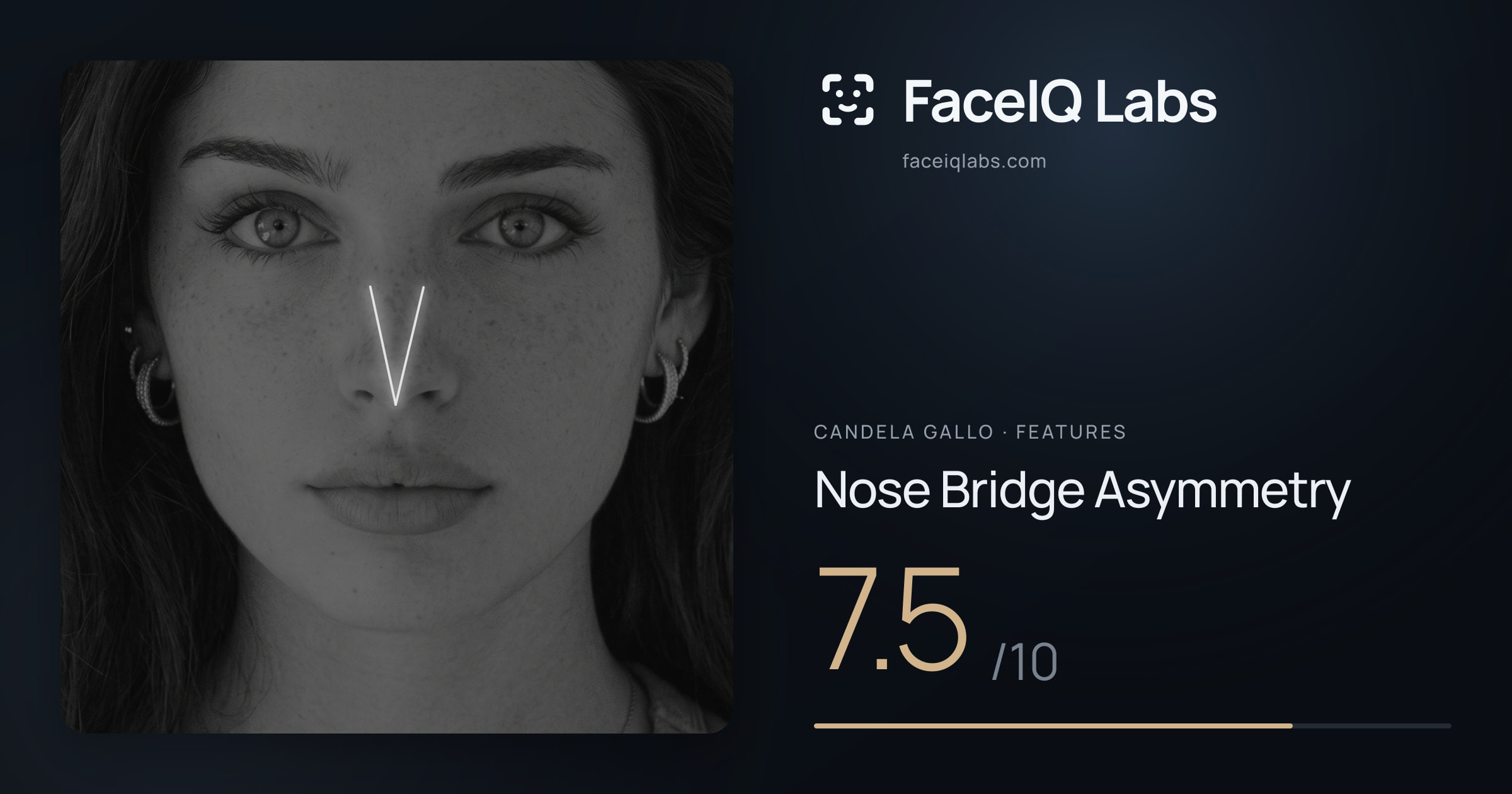 Candela Gallo Nose Bridge Asymmetry: 7.5/10, drawn on the photo