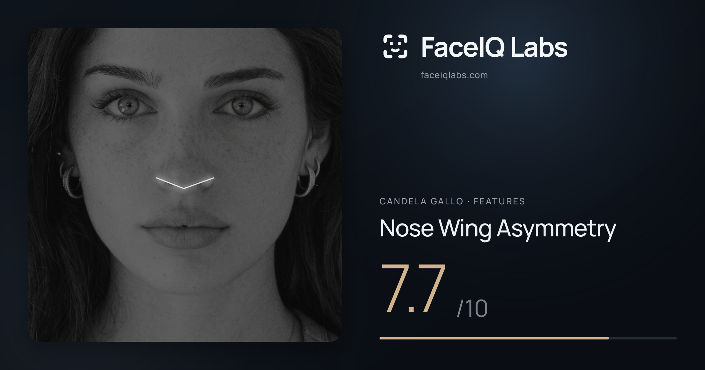 Candela Gallo Nose Wing Asymmetry: 7.7/10, drawn on the photo