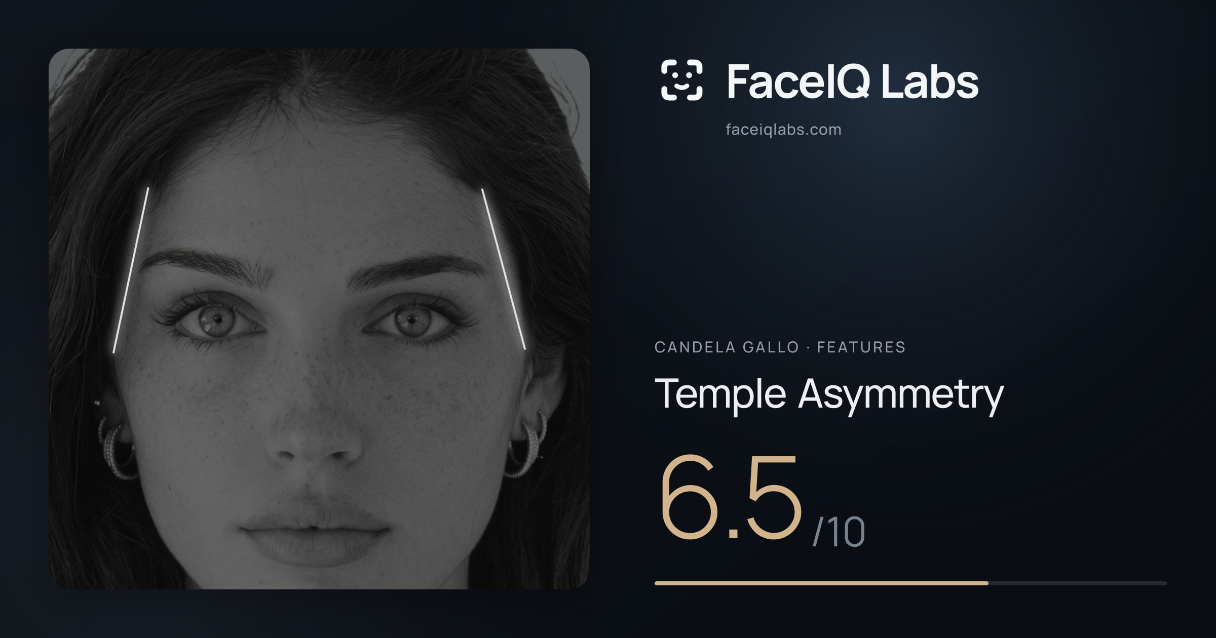 Candela Gallo Temple Asymmetry: 6.5/10, drawn on the photo