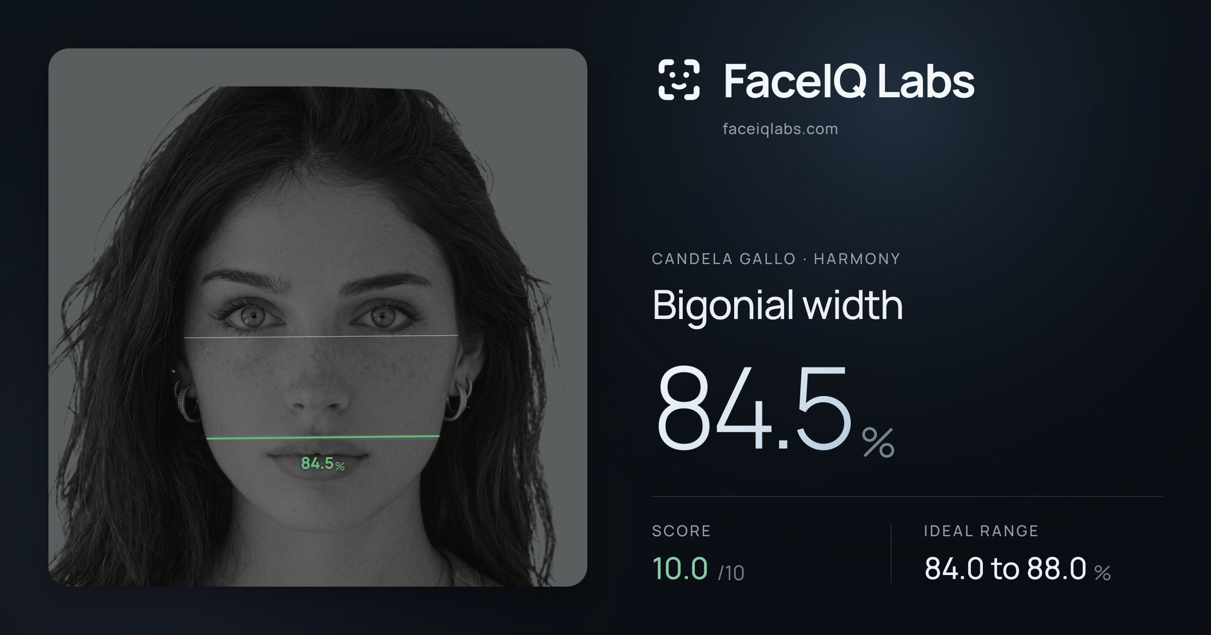 Candela Gallo Bigonial width: 84.5%, drawn on the photo