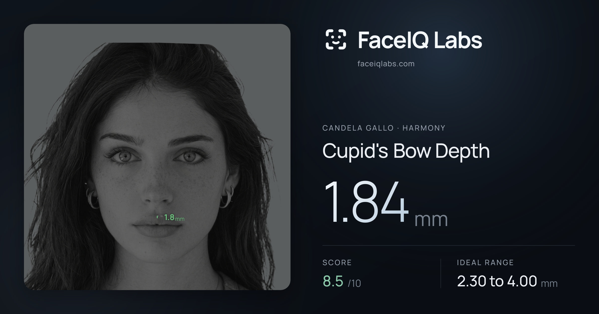 Candela Gallo Cupid's Bow Depth: 0.25mm, drawn on the photo