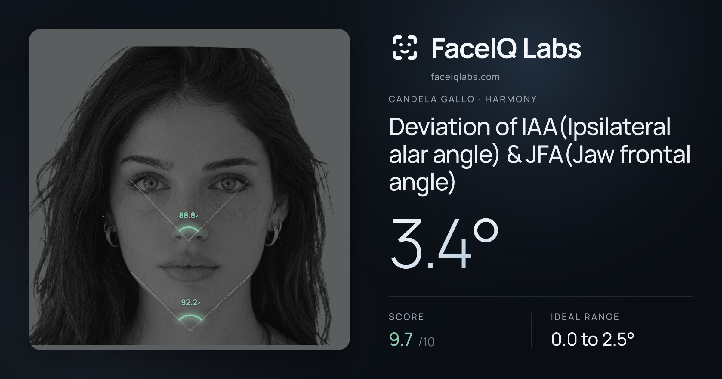 Candela Gallo Deviation of IAA(Ipsilateral alar angle) & JFA(Jaw frontal angle): 3.4°, drawn on the photo
