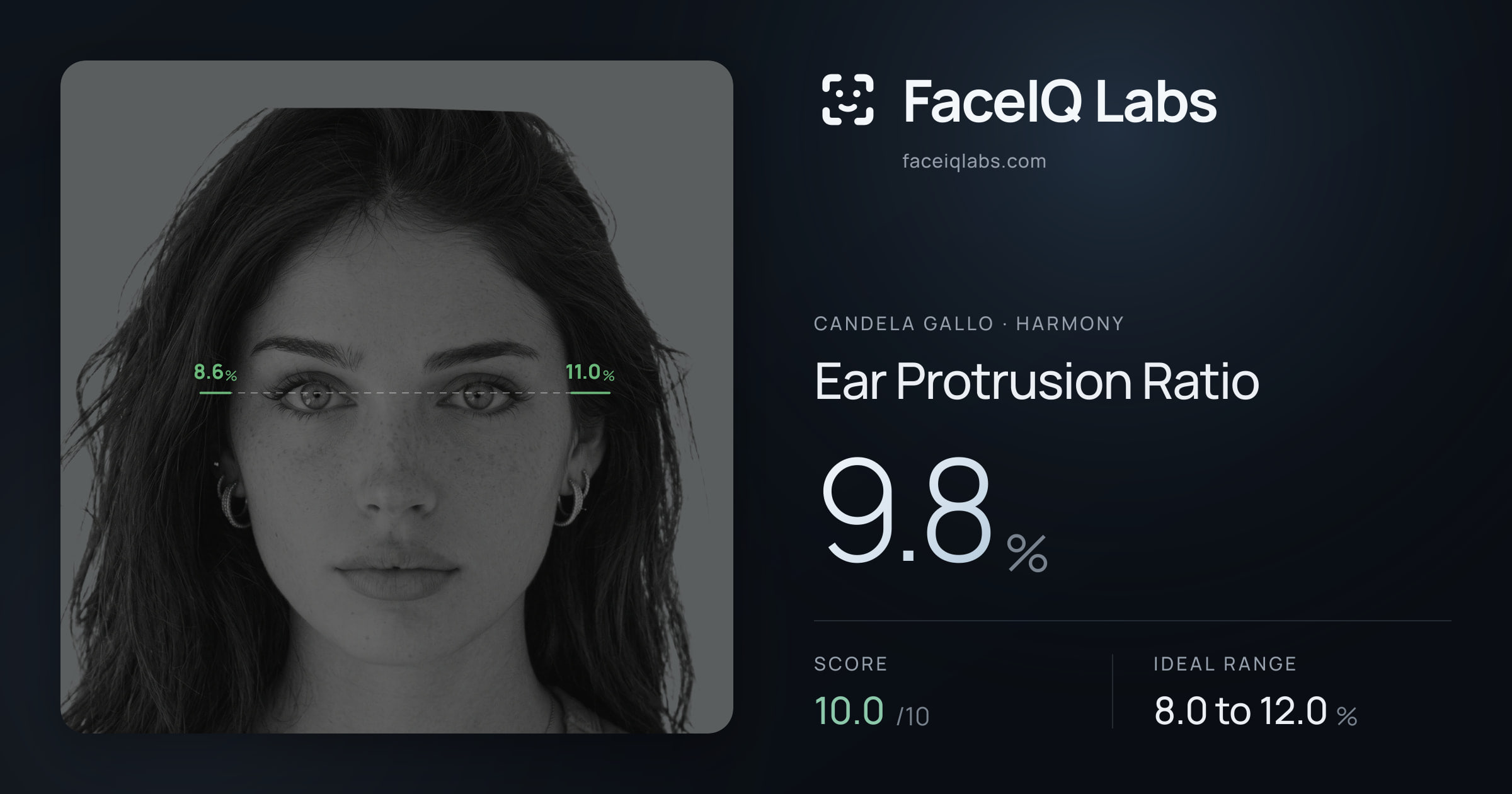 Candela Gallo Ear Protrusion Ratio: 9.8%, drawn on the photo